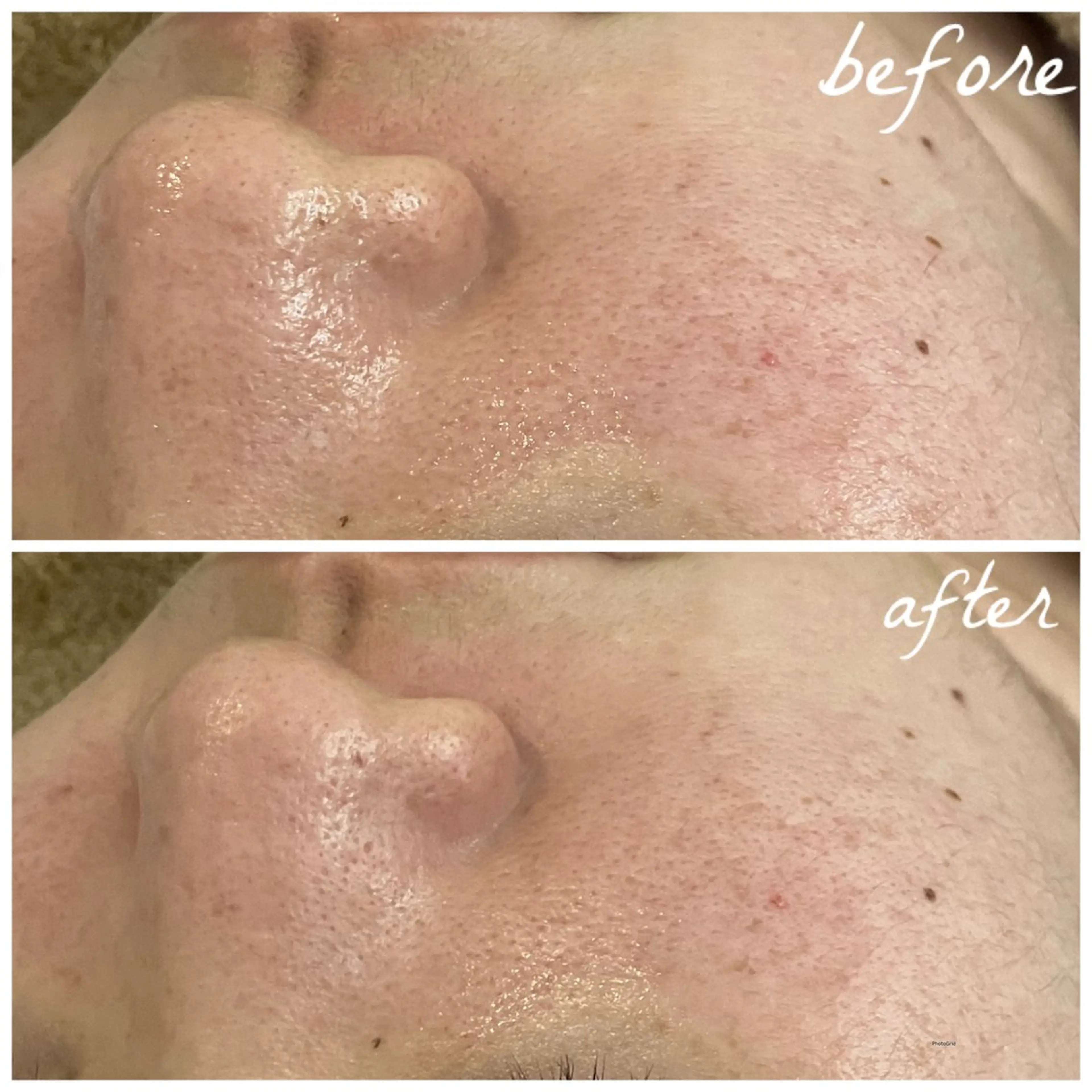 メンズ エステ メナード岐阜茜部 杉浦のエステ・リラクイメージ