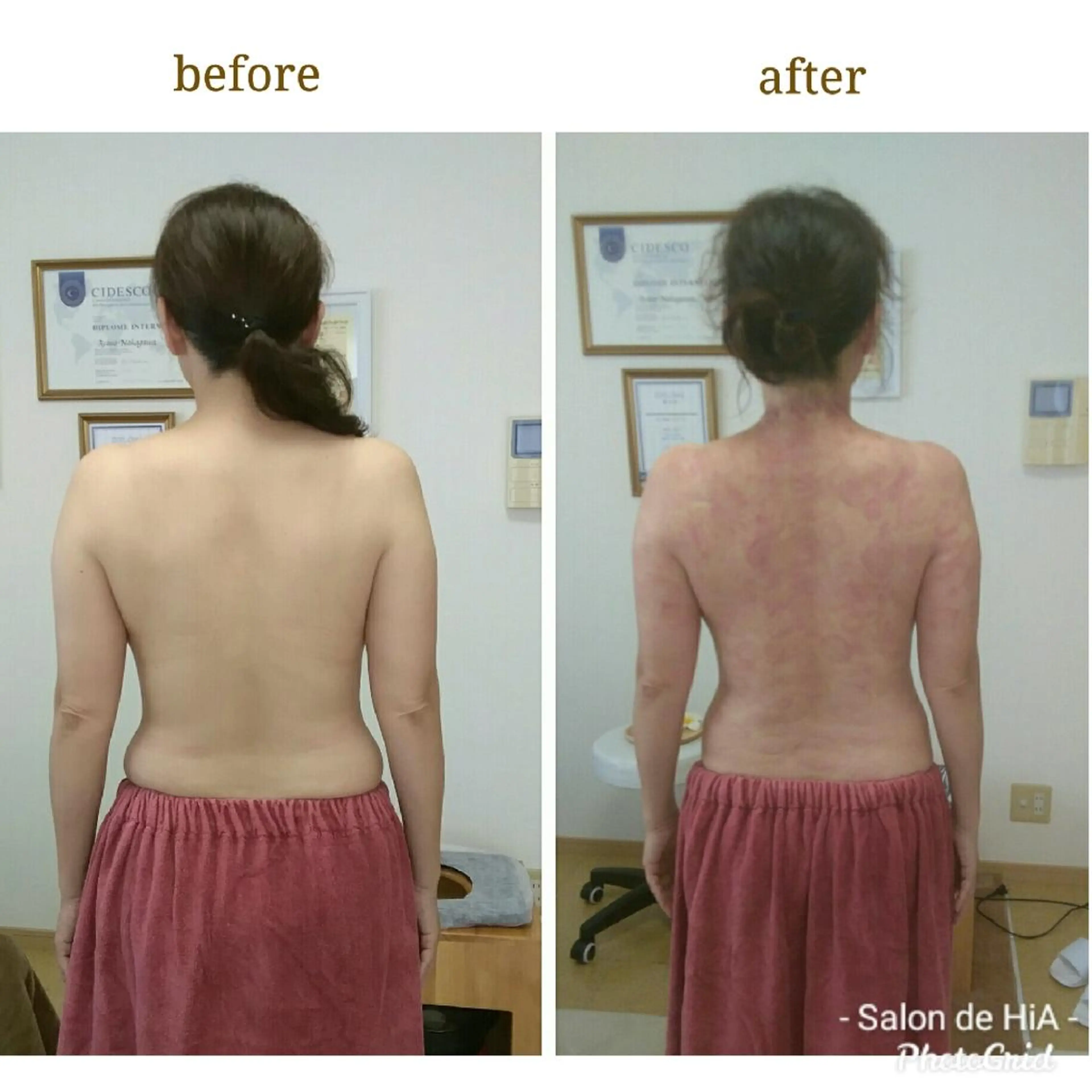 70分🕐️【上半身痩せ】上半身痩せ３点セットコースの写真