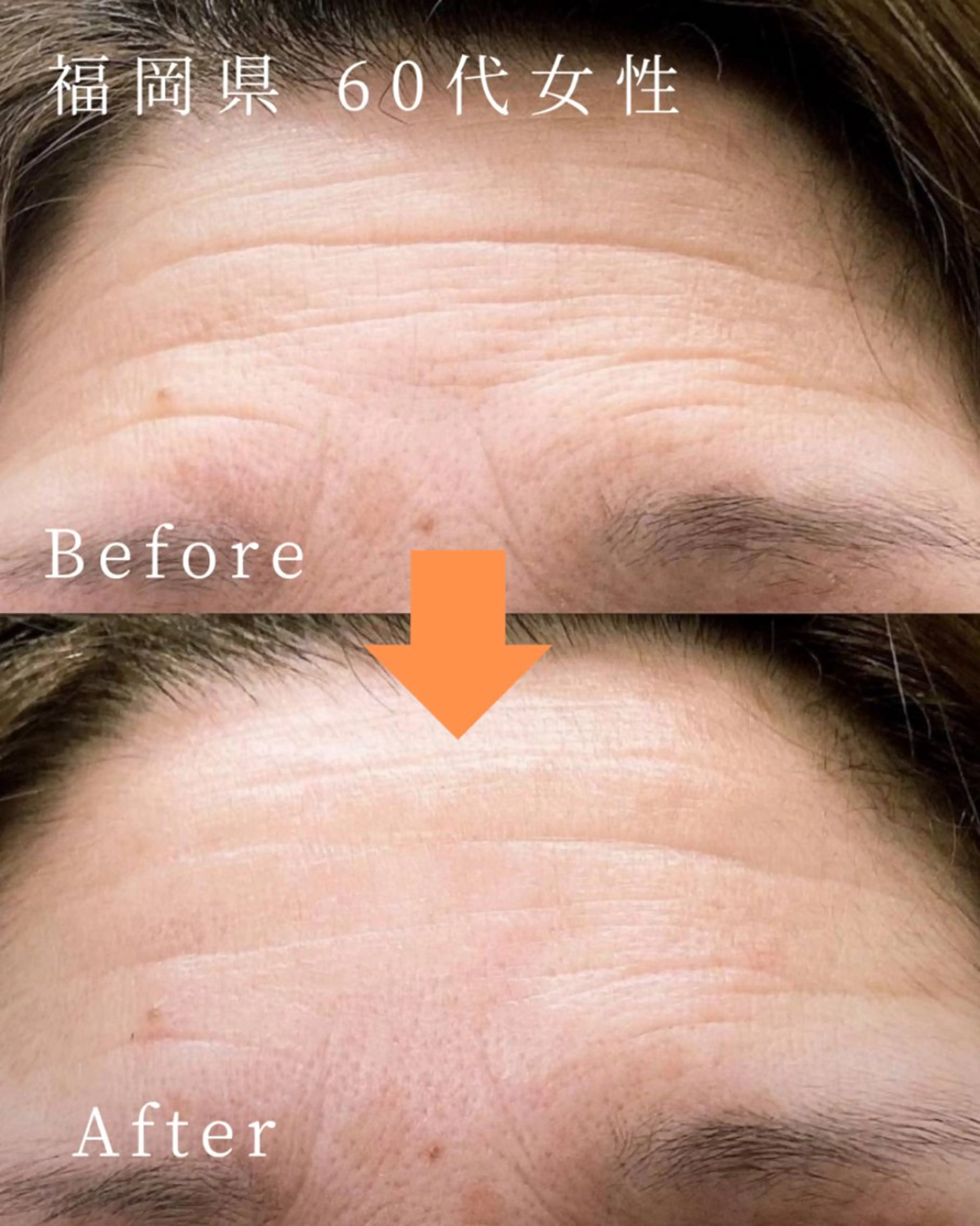 天使のしずく 神戸店所属・幹細胞エクソソーム 専門店 天使のしずくのその他イメージ