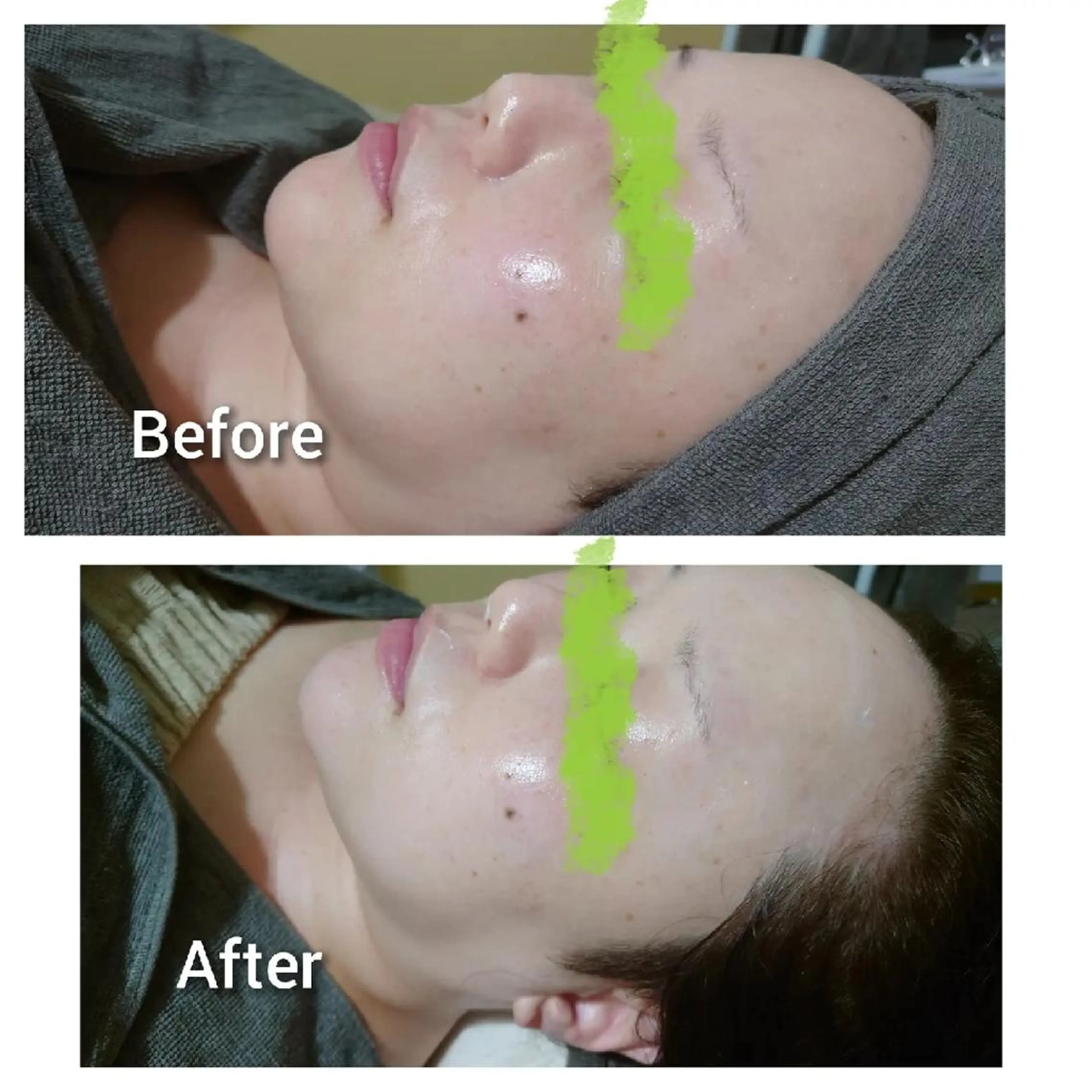 エステ Beauty Salon Luana所属・Luanaまつパ脱毛 ハーブピーリング眉毛のマツエク・マツパデザイン