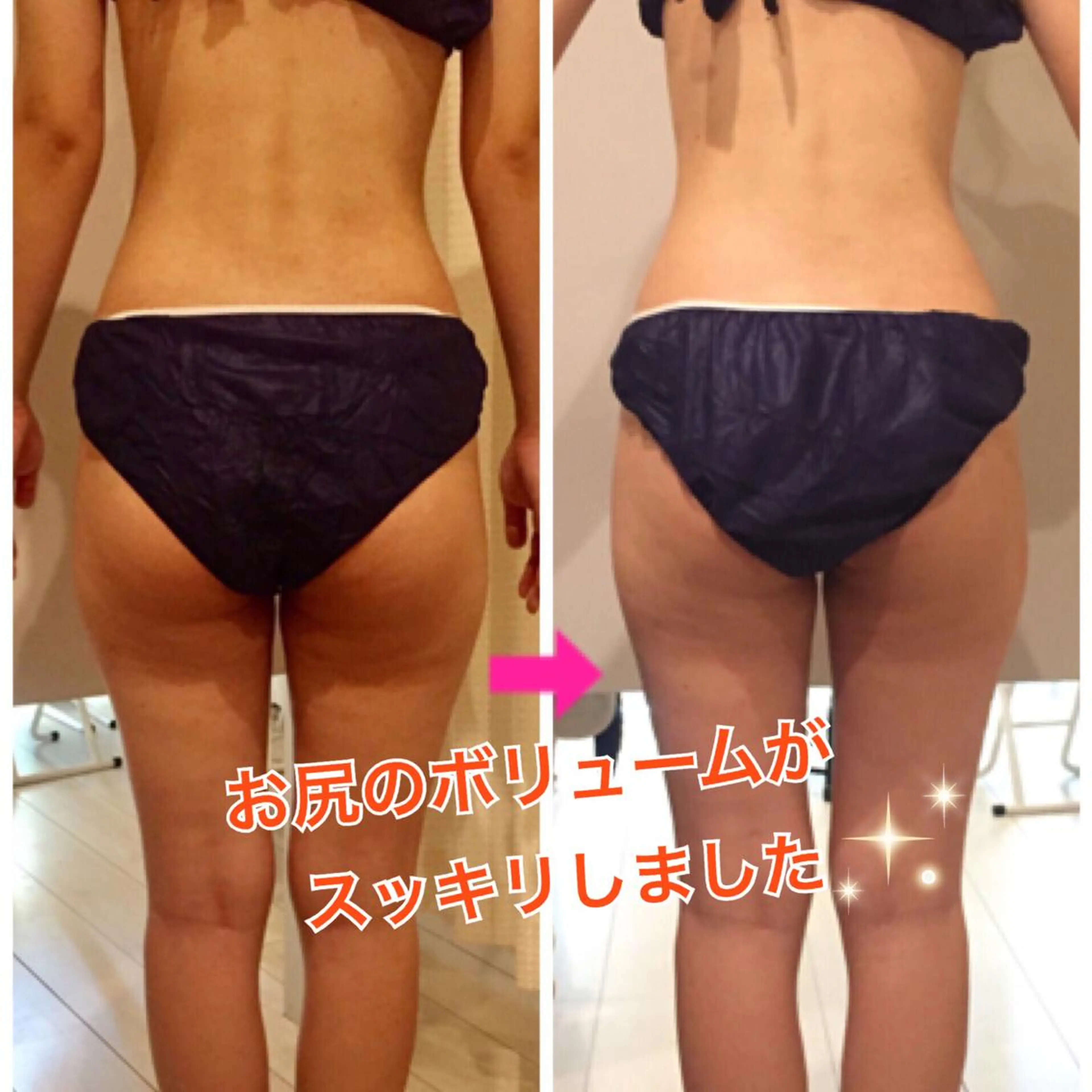 ロング カラー パーマ ヘアアレンジ メンズ キッズ ネイル マツエク・マツパ ‍痩身＆ボディ 結果出し🌟丹野のエステ・リラクイメージ