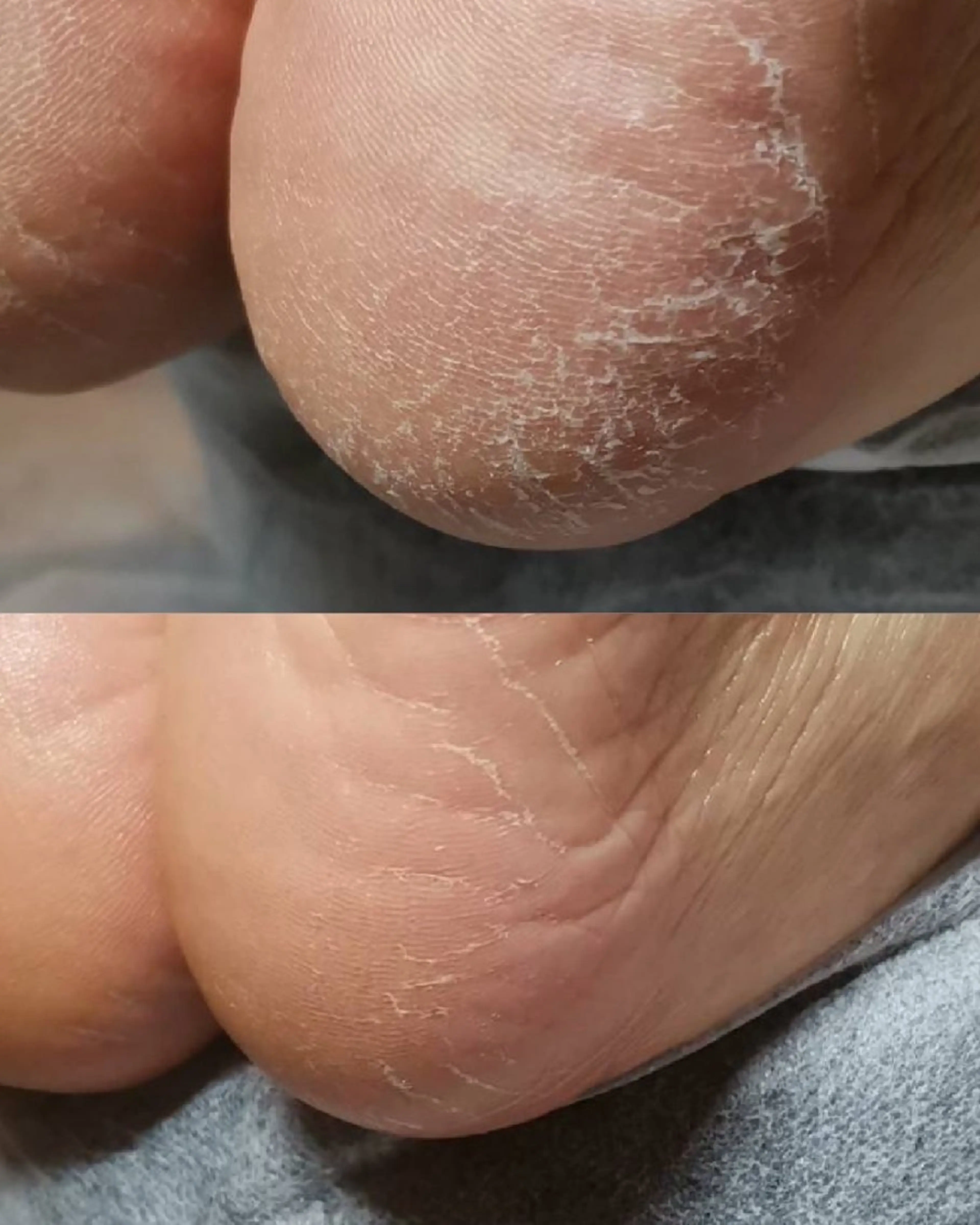 ネイル ROUN' 齋藤のエステ・リラクイメージ