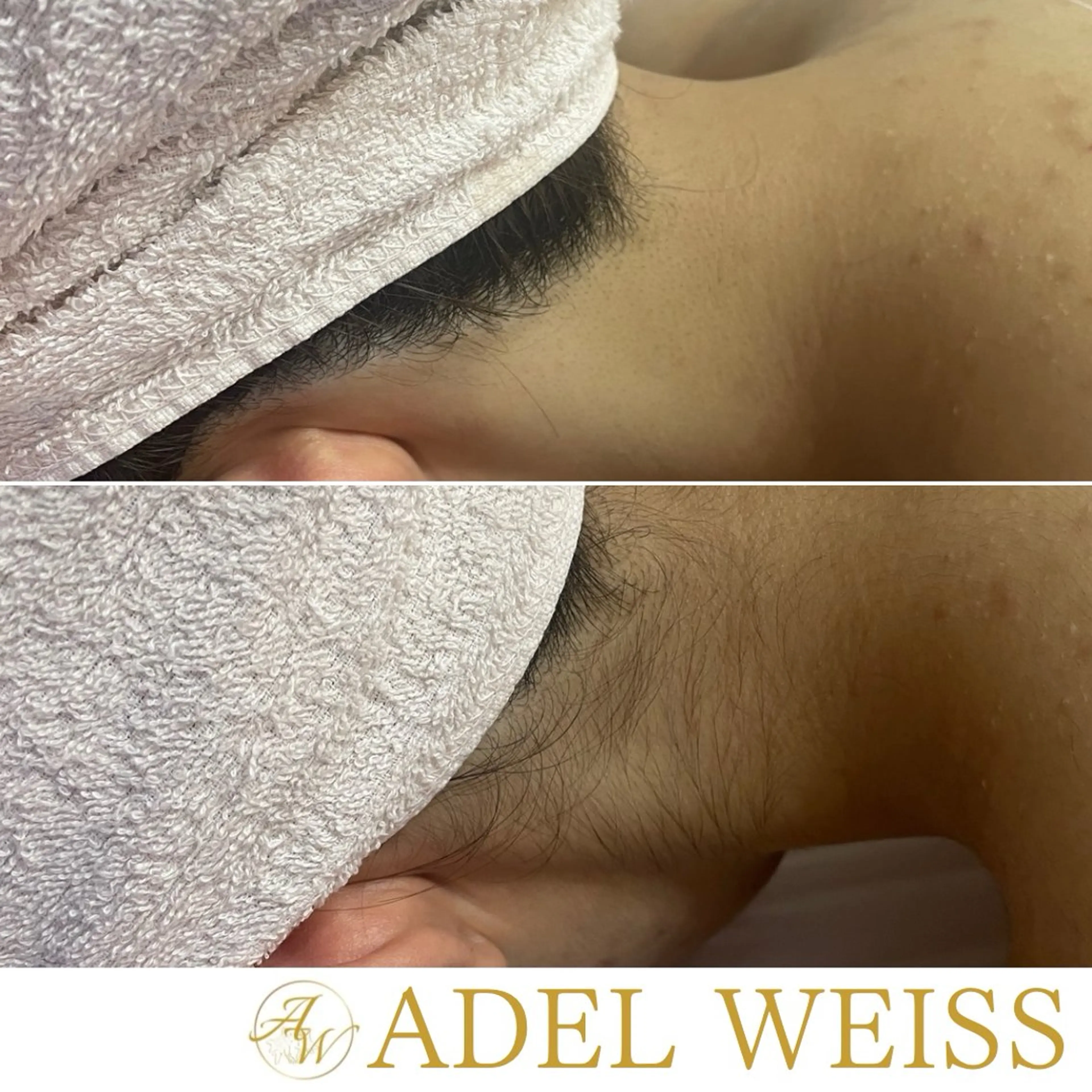 脱毛 Total Beauty Salon ADEL WEISS所属・ADEL WEISS 脱毛&毛穴&リンパのエステ・リラクイメージ