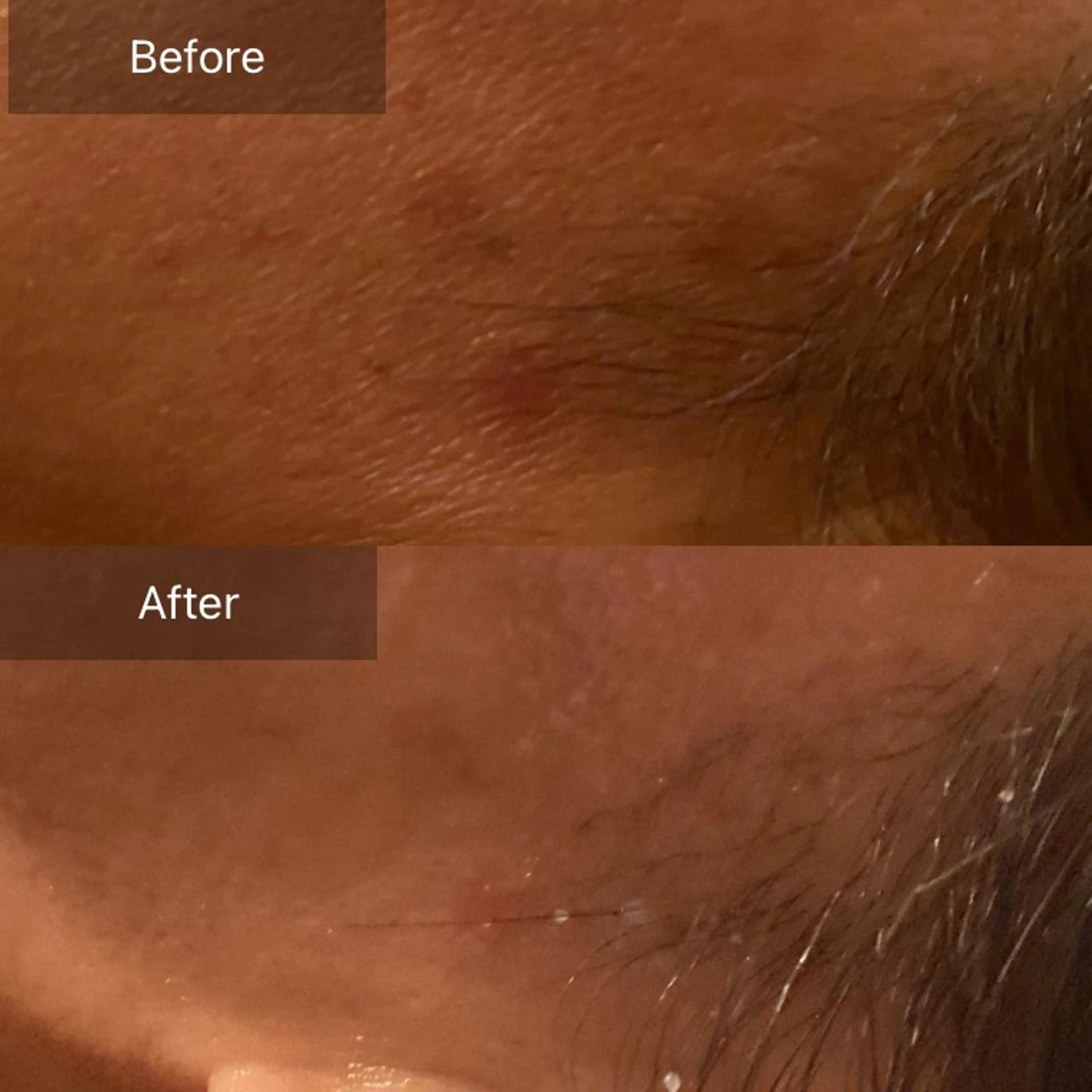 Mandarin Orange所属・毛穴から始める肌メン テマンダリンオレンジのエステ・リラクイメージ