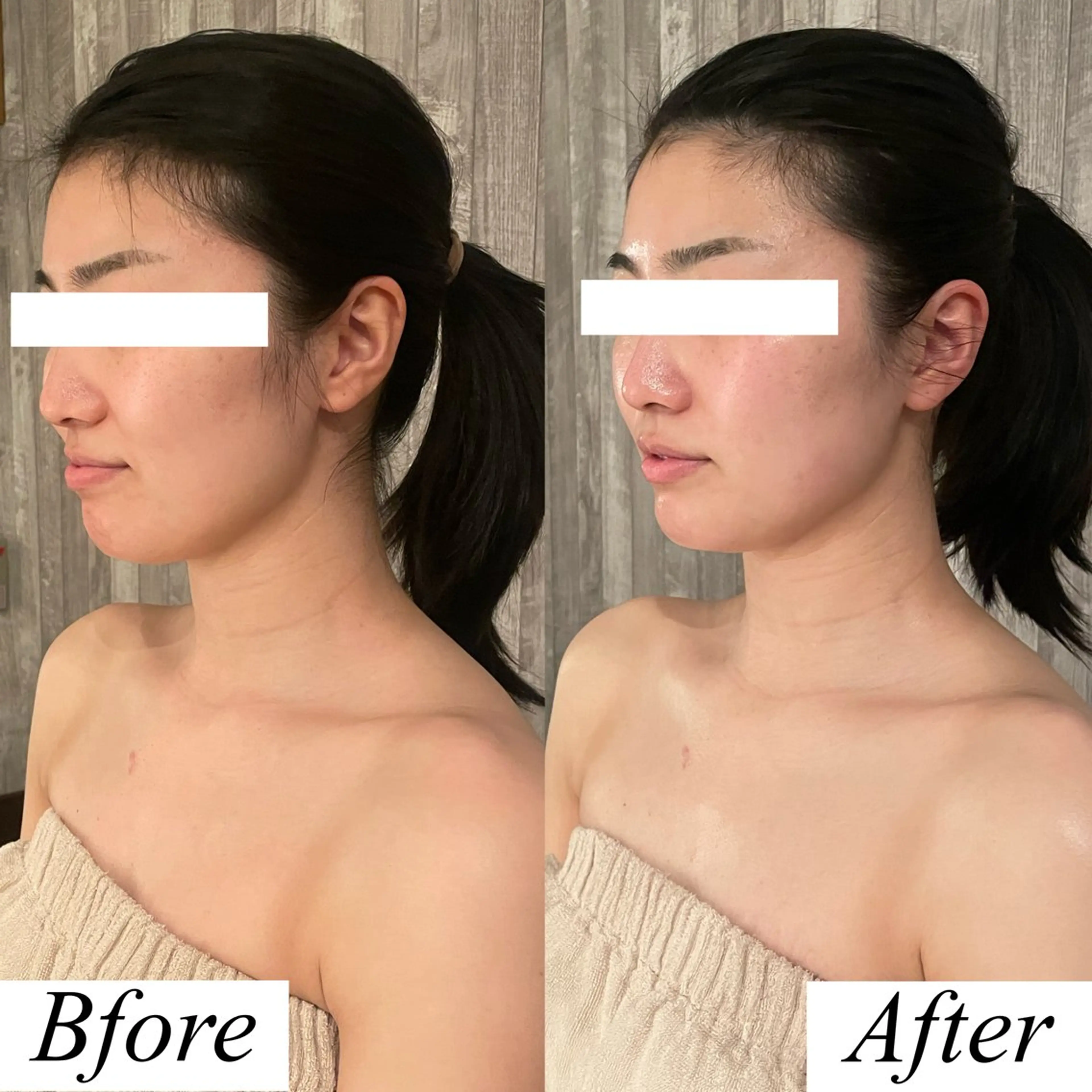 グレースフィオーレ上野御徒町店所属・頭蓋骨小顔矯正 上野御徒町店＊かんなのエステ・リラクイメージ