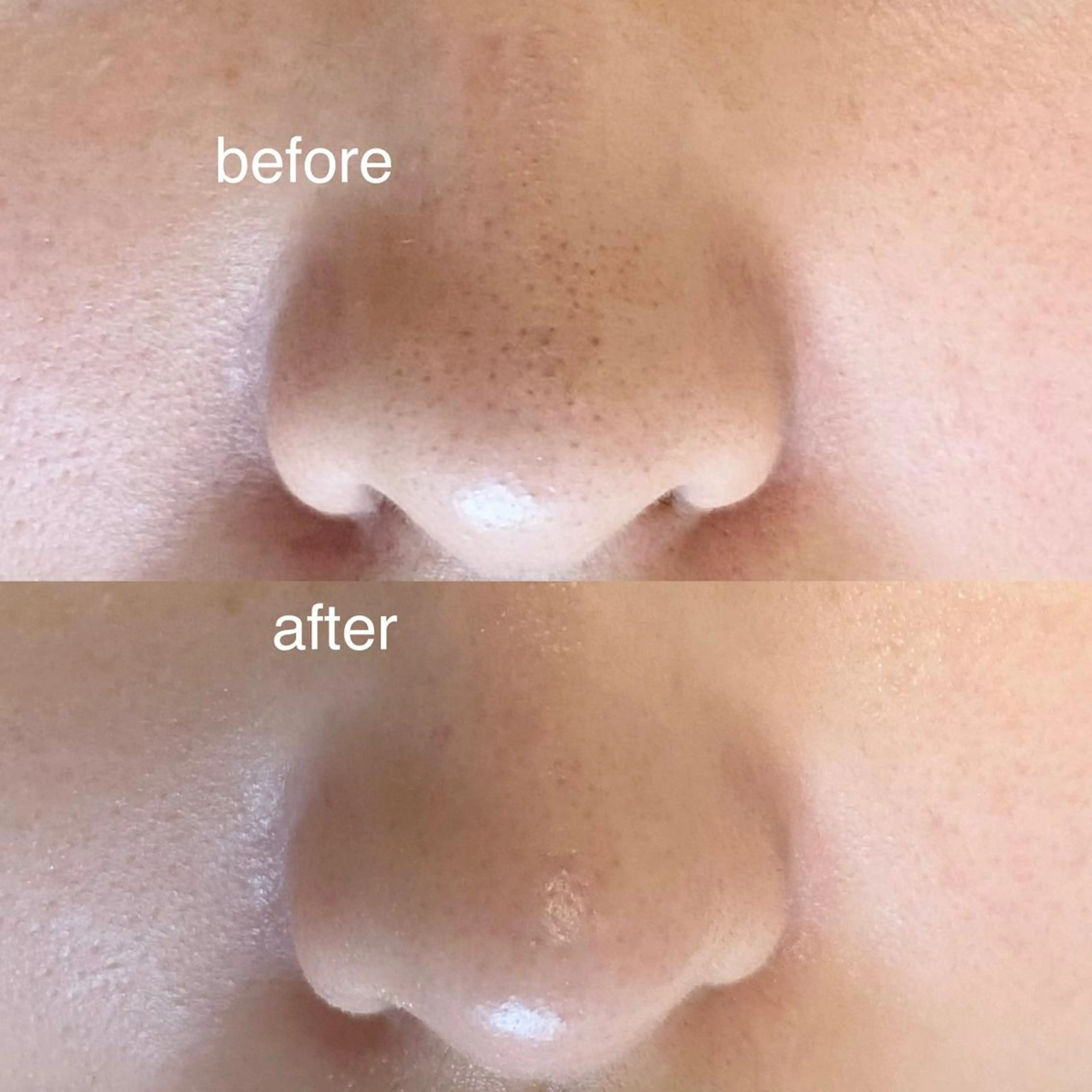 毛穴専門サロン　フルール所属・フルールFululu 自由が丘のエステ・リラクイメージ