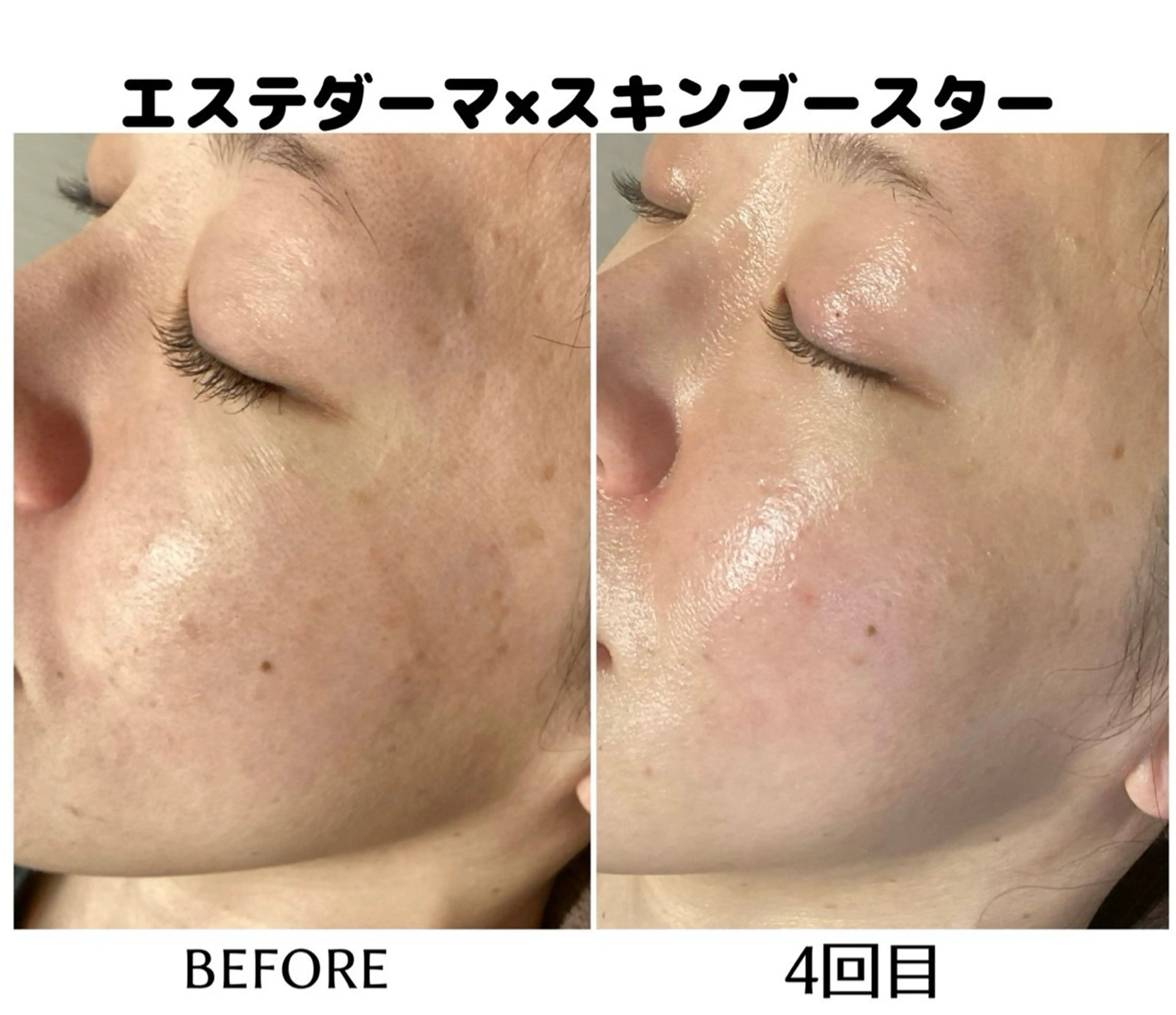 SOIS上中居店所属・佐々木 麻裕のエステ・リラクイメージ