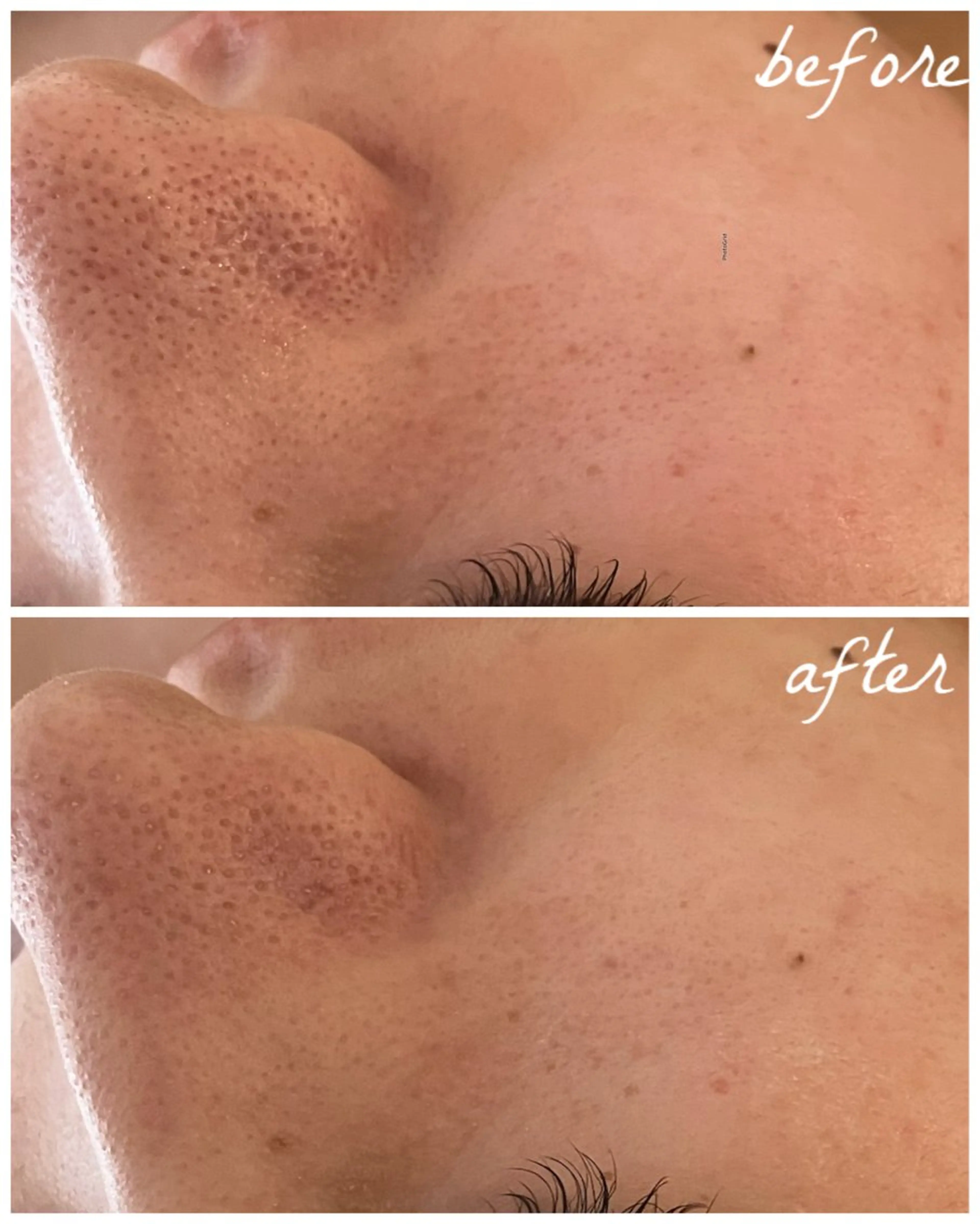 メンズ エステ メナード岐阜茜部 杉浦のエステ・リラクイメージ