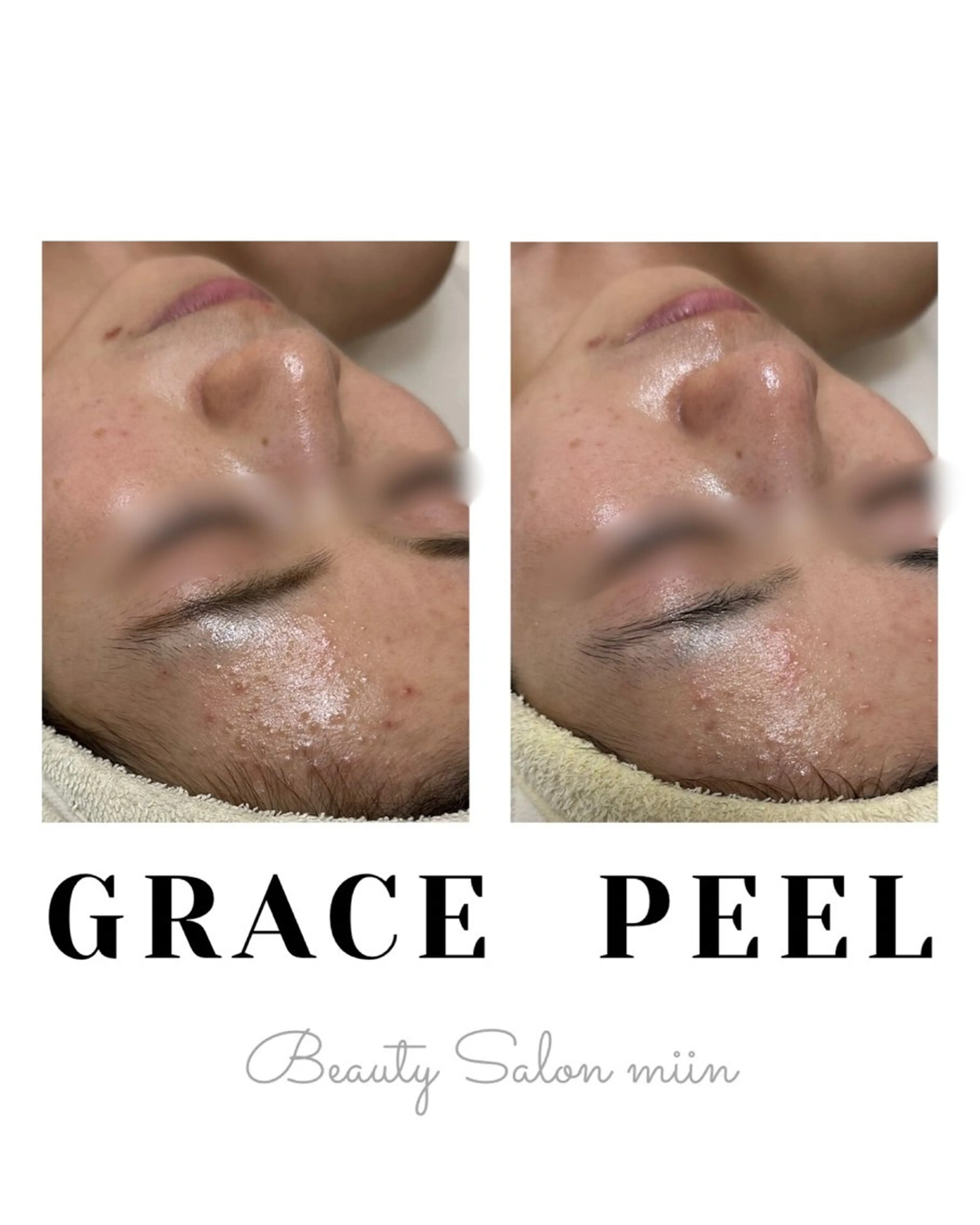 エステ 韓国肌管理 白玉肌管理®︎のエステ・リラクイメージ