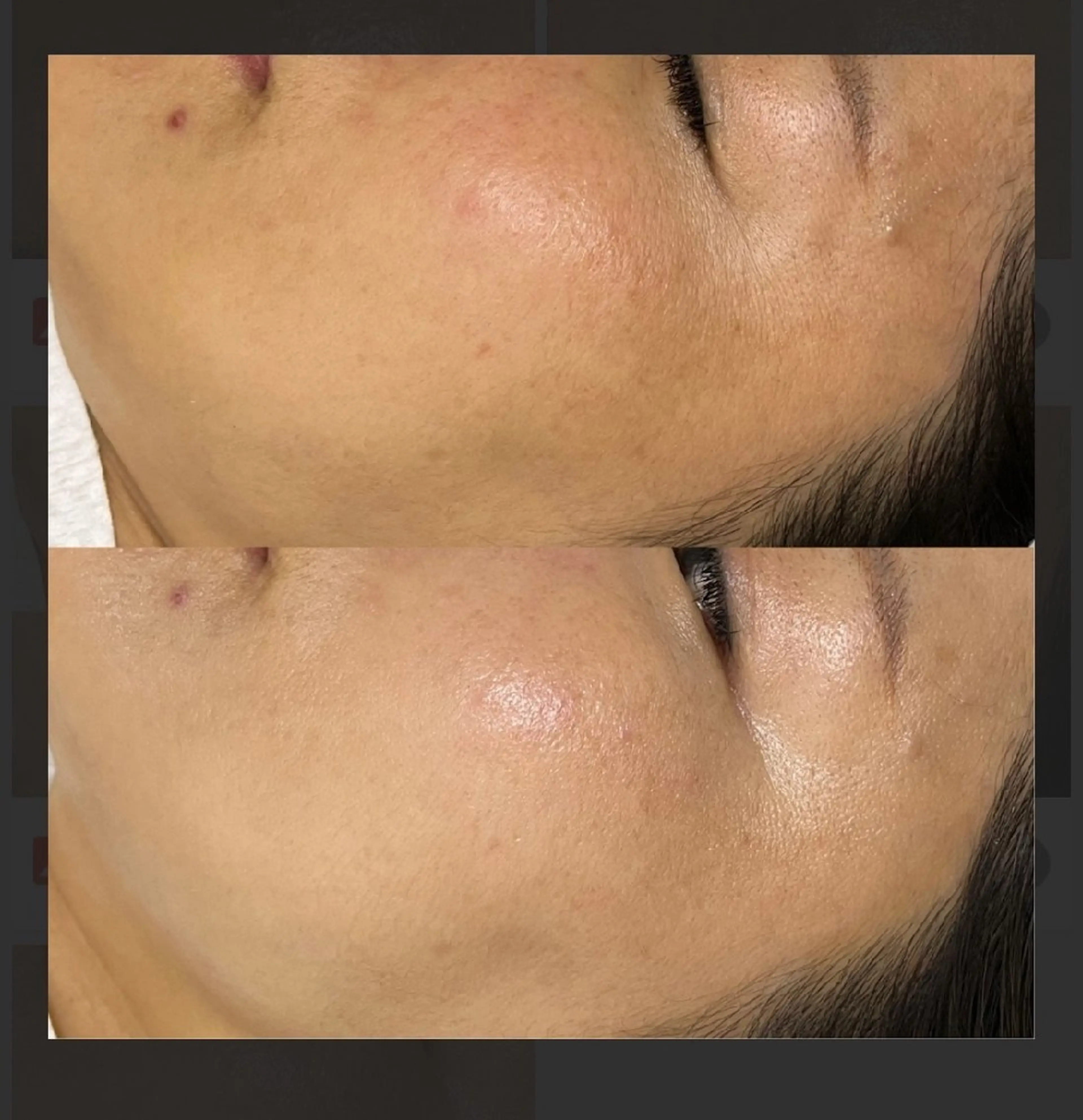 ハルモニア所属・エステハルモニア はるかのエステ・リラクイメージ