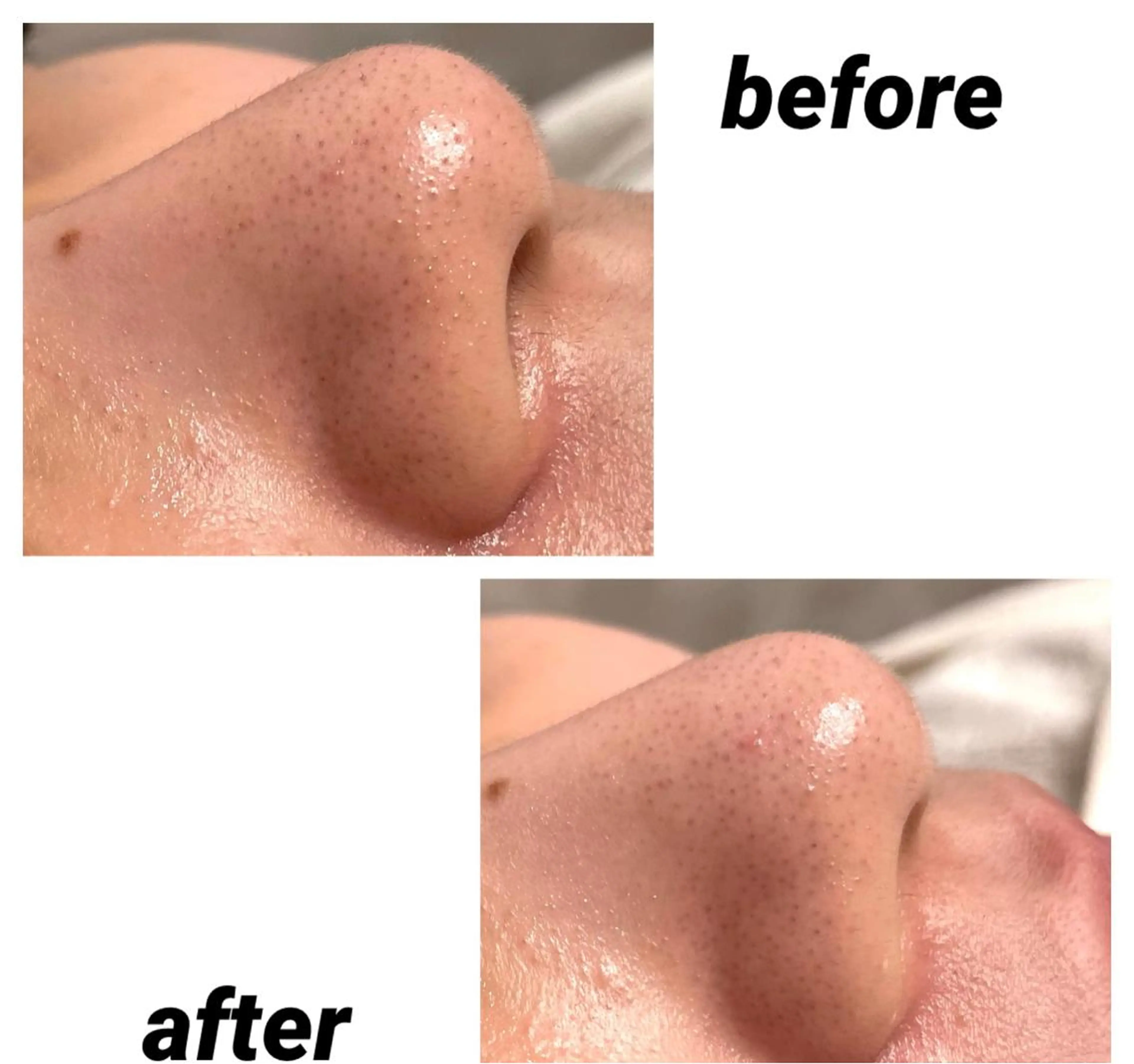 DeI'm   名古屋栄所属・小林 玲菜のエステ・リラクイメージ