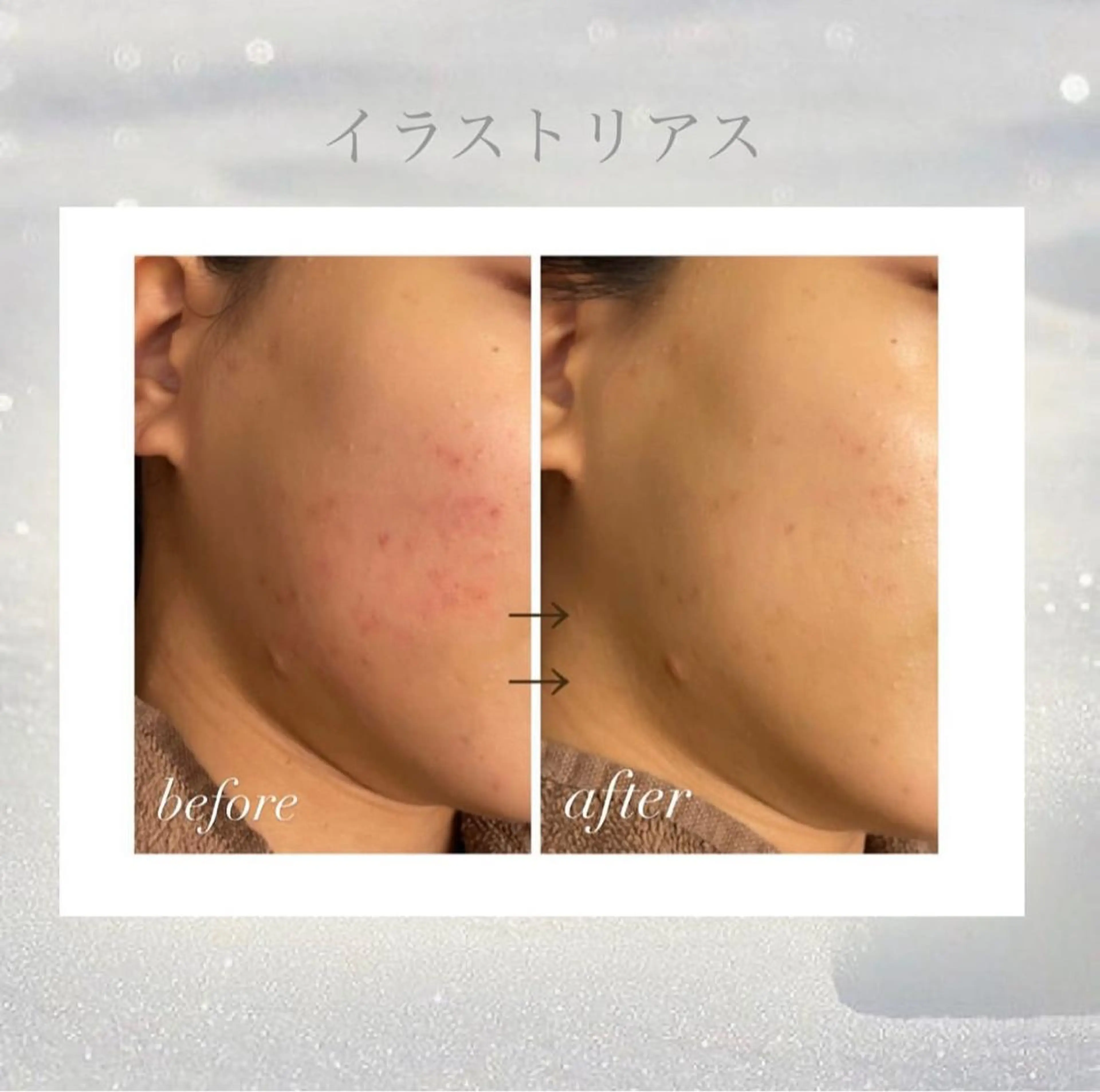 エステ 🦋美肌サロン. maho🦋のエステ・リラクイメージ