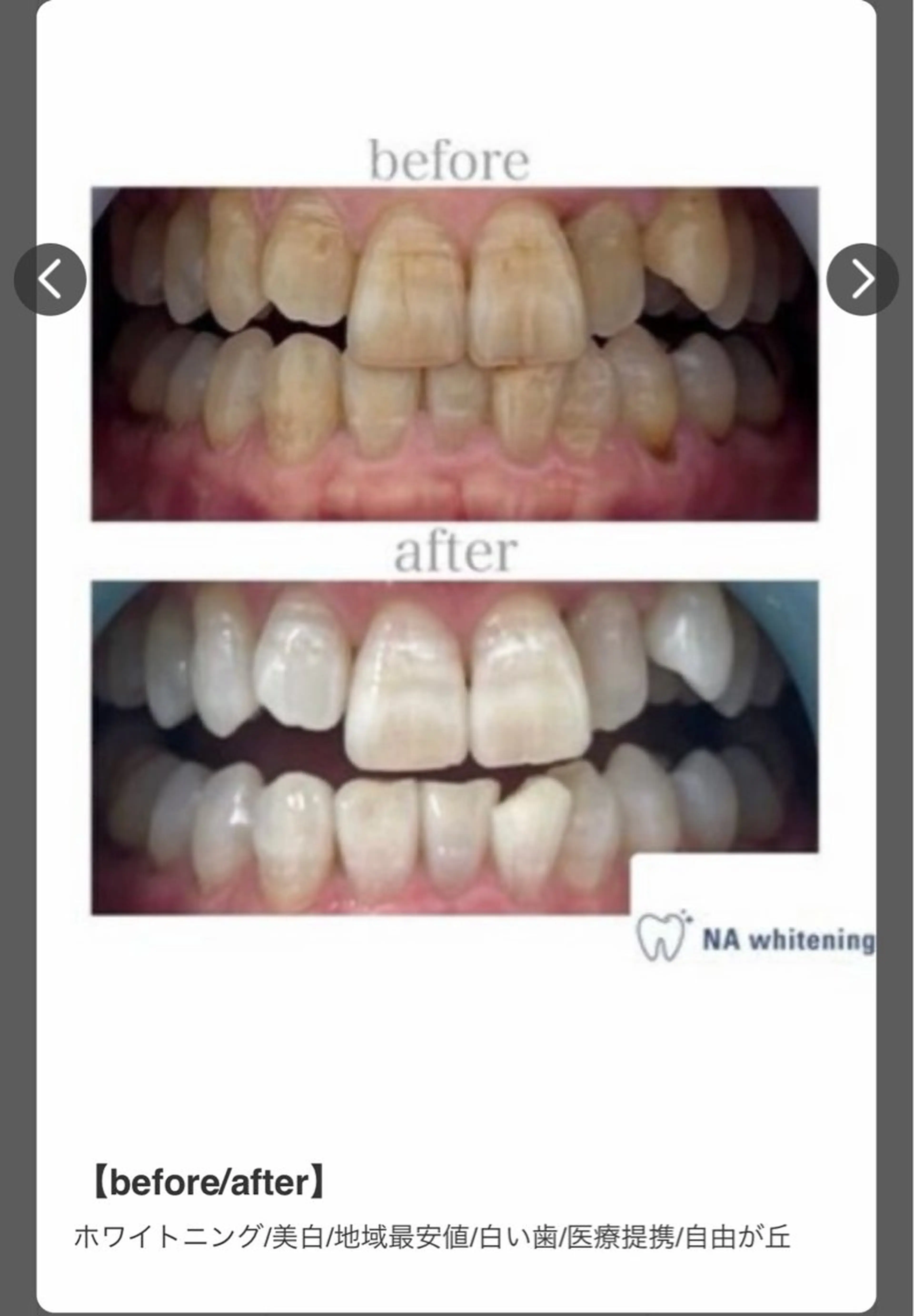 エミルカ　自由が丘店所属・ニキビ改善ハーブ🌿 ハナシマのその他イメージ