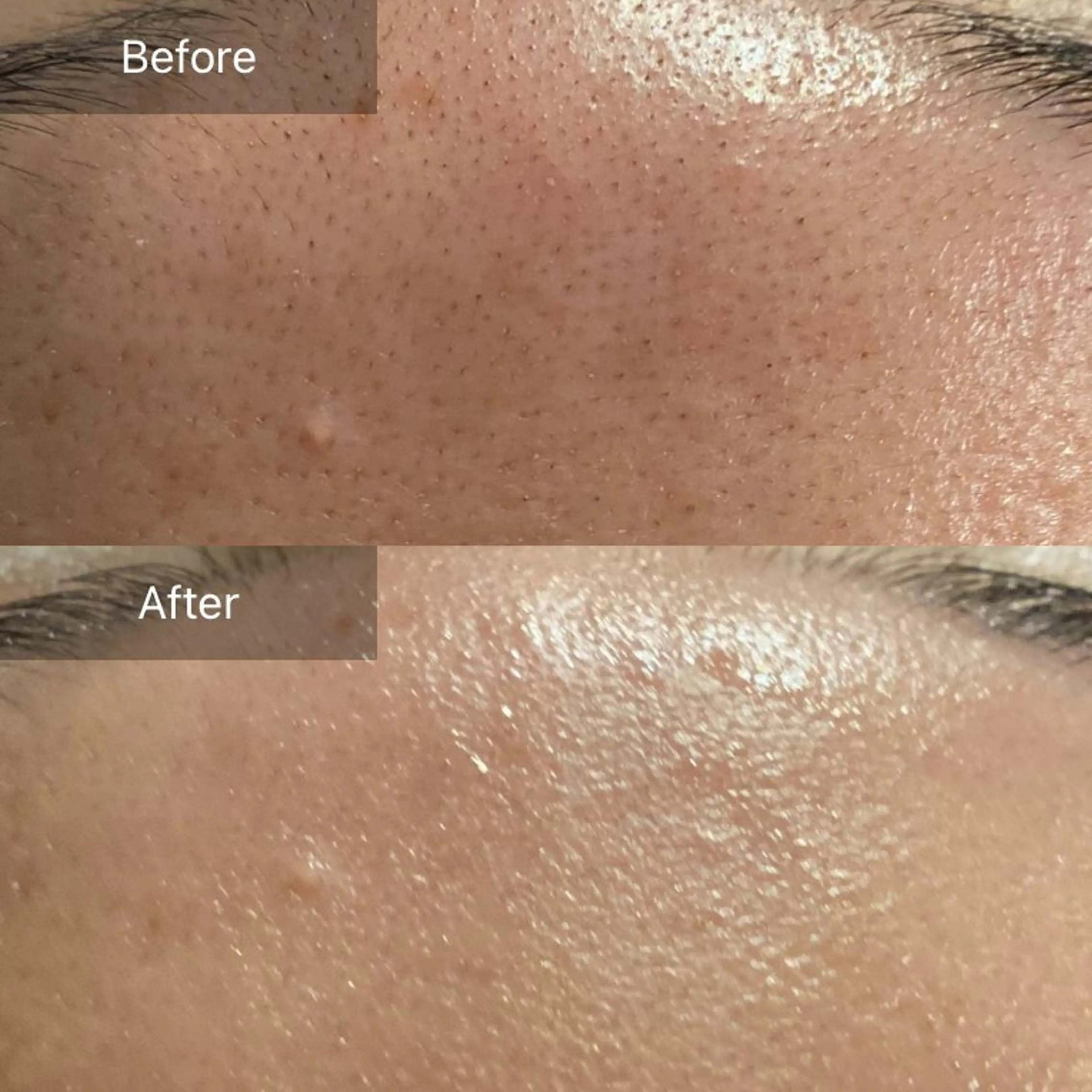 エステ リラク Mandarin Orange所属・毛穴から始める肌メン テマンダリンオレンジのエステ・リラクイメージ