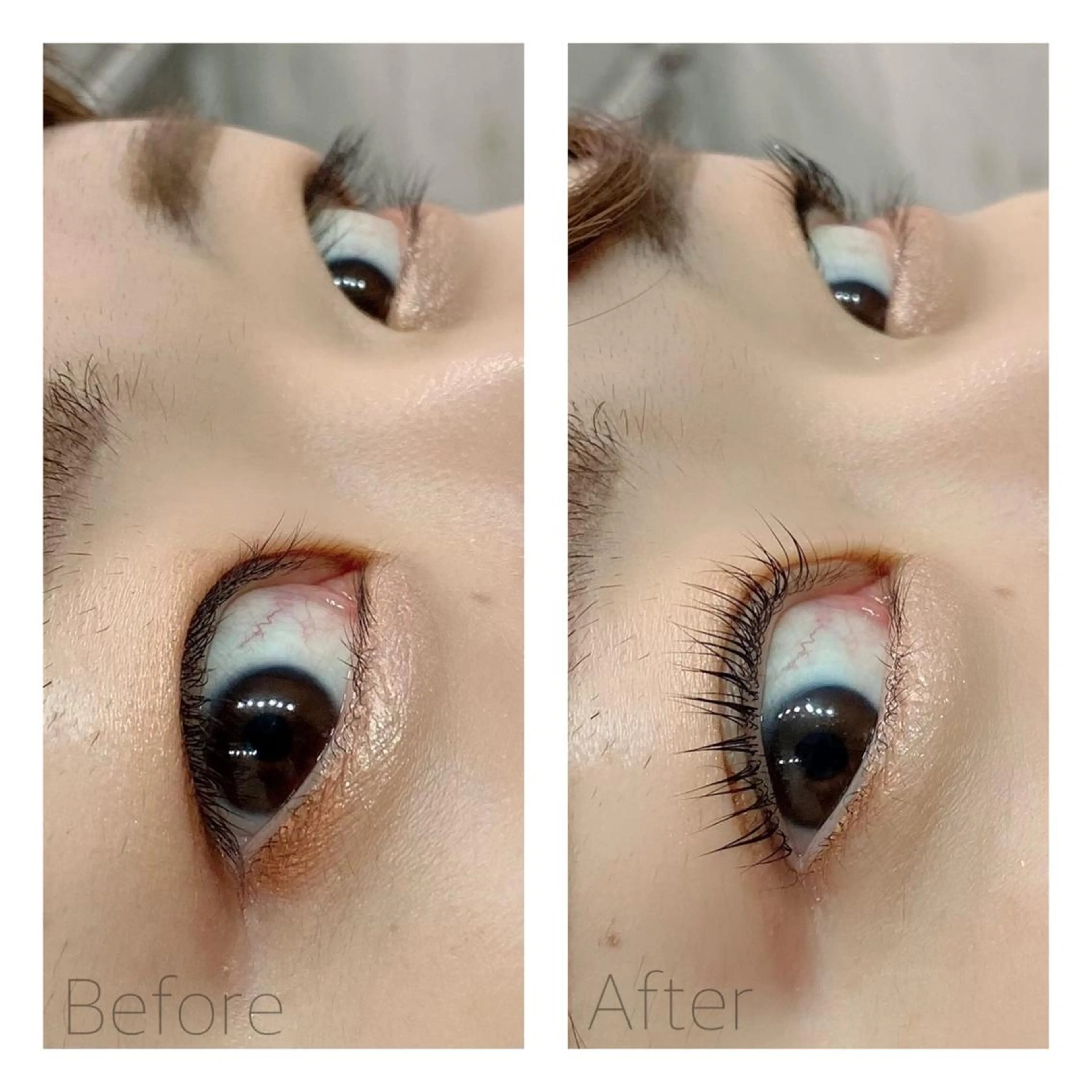 マツエク・マツパ schön所属・schön 松井のエステ・リラクイメージ