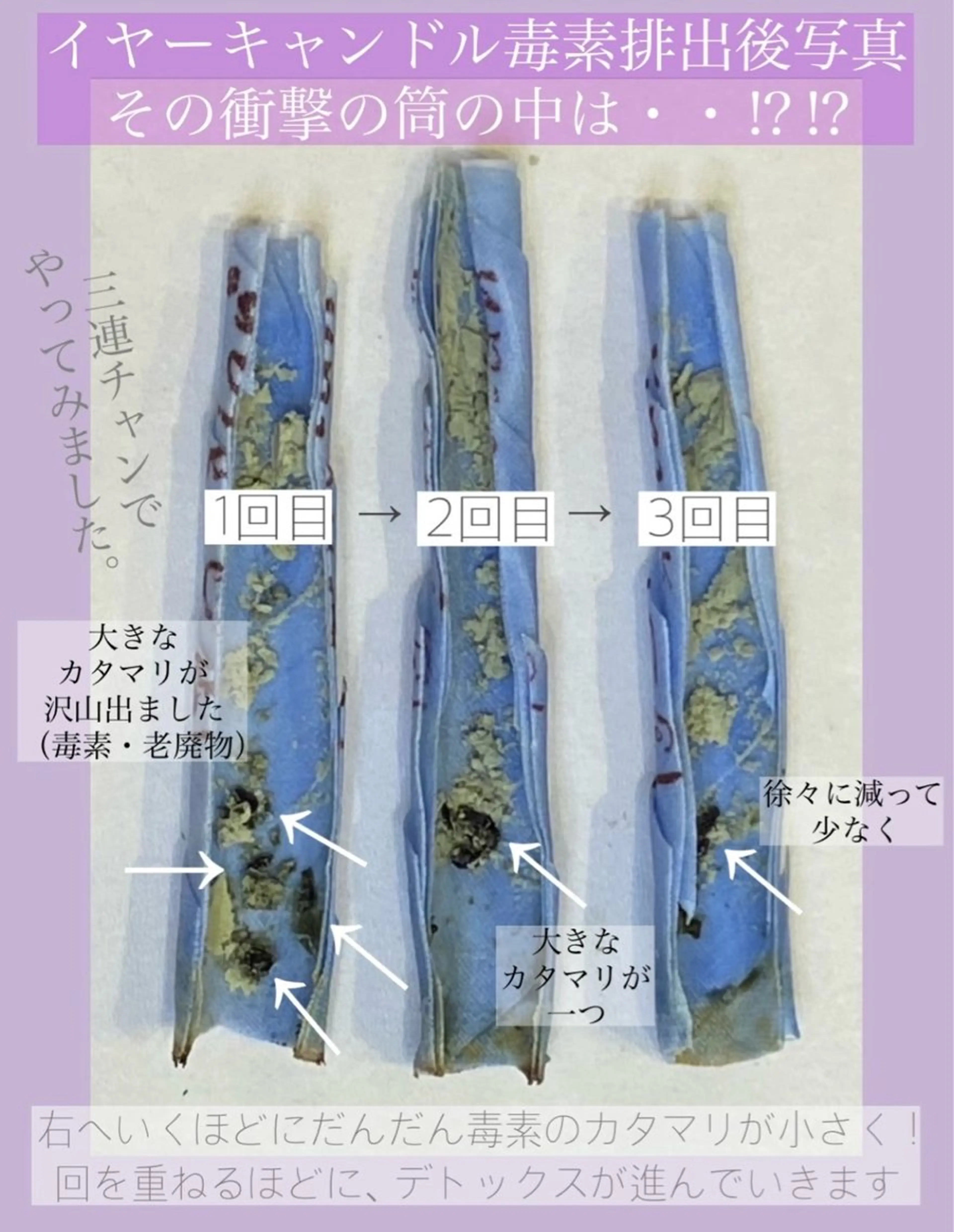 その他 エステティックサロン向日葵　三宮店所属・エステティックサロン 向日葵三宮店のその他イメージ