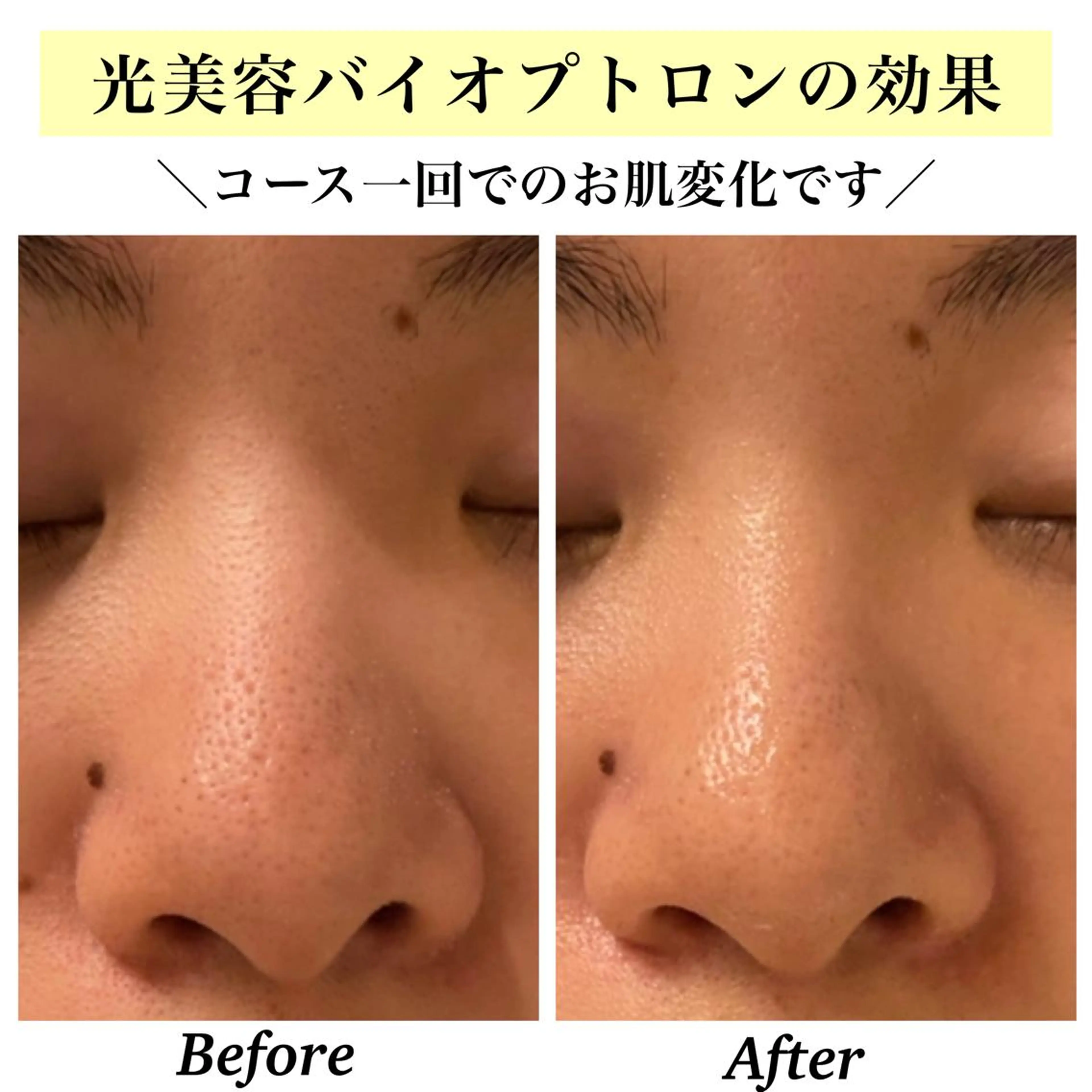 エステ リラク Bellesthe （ベルエステ）のエステ・リラクイメージ