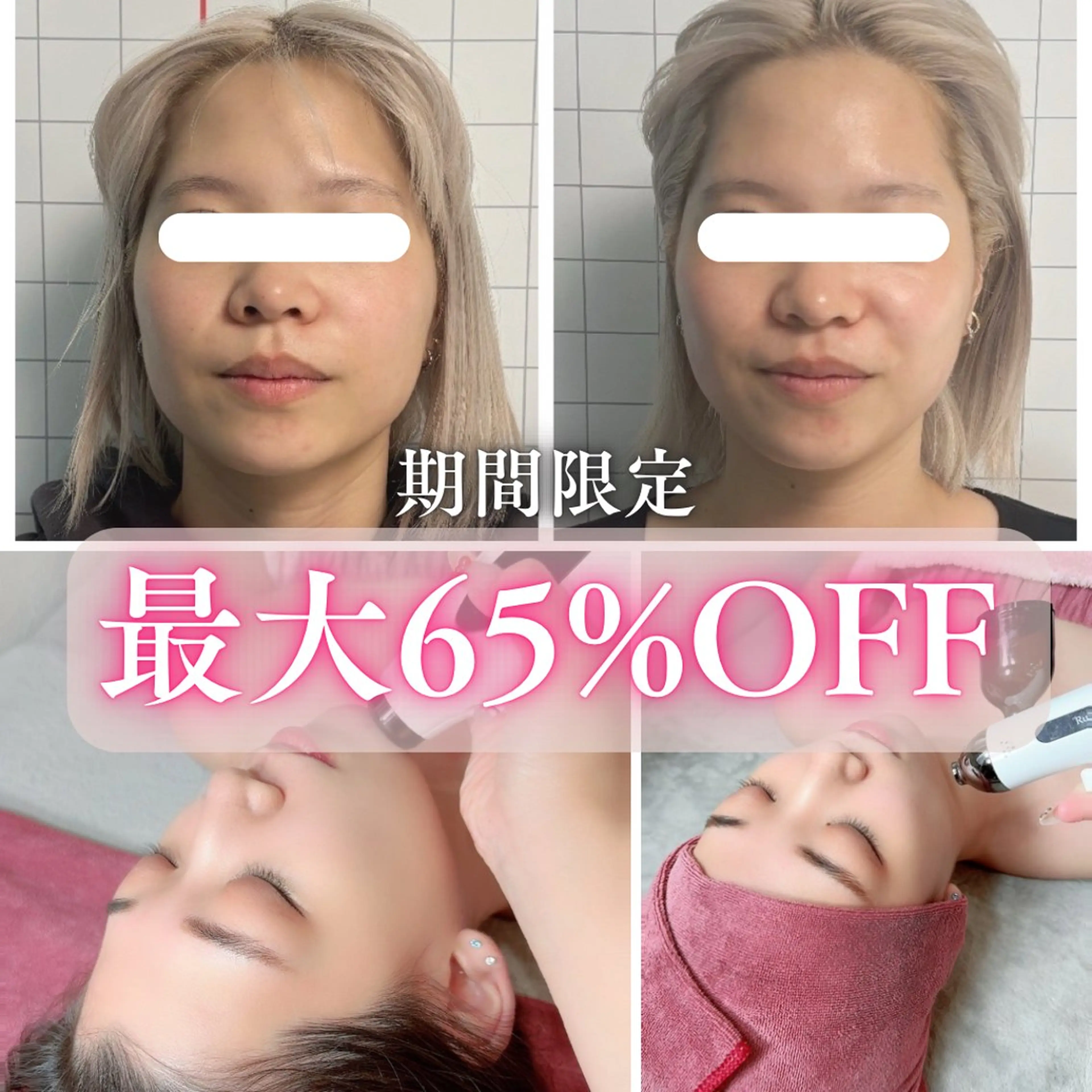 エステ リラク 小顔矯正専門店 【RED】池田のエステ・リラクイメージ