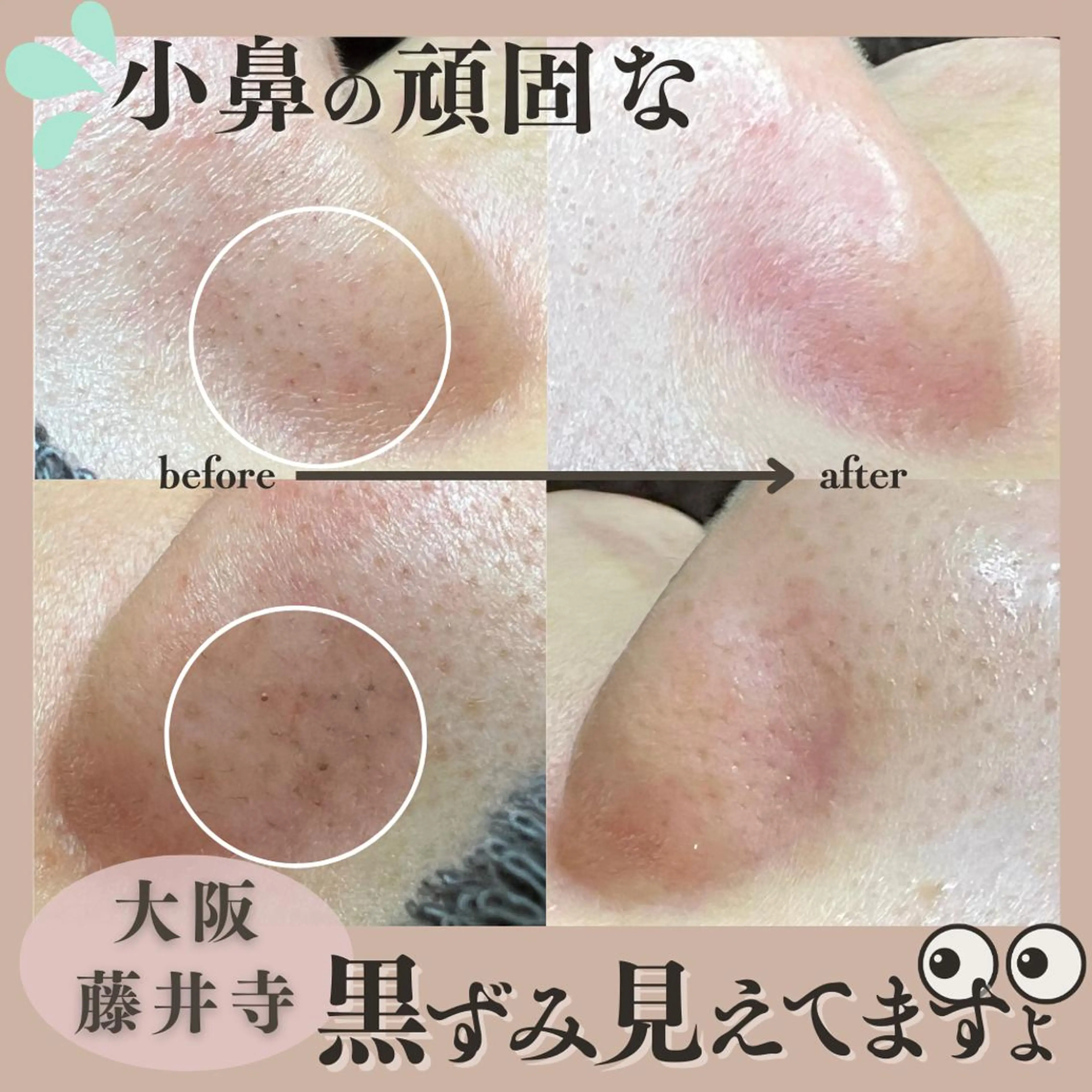 Muqu.所属・Muqu. 毛穴サロンのエステ・リラクイメージ