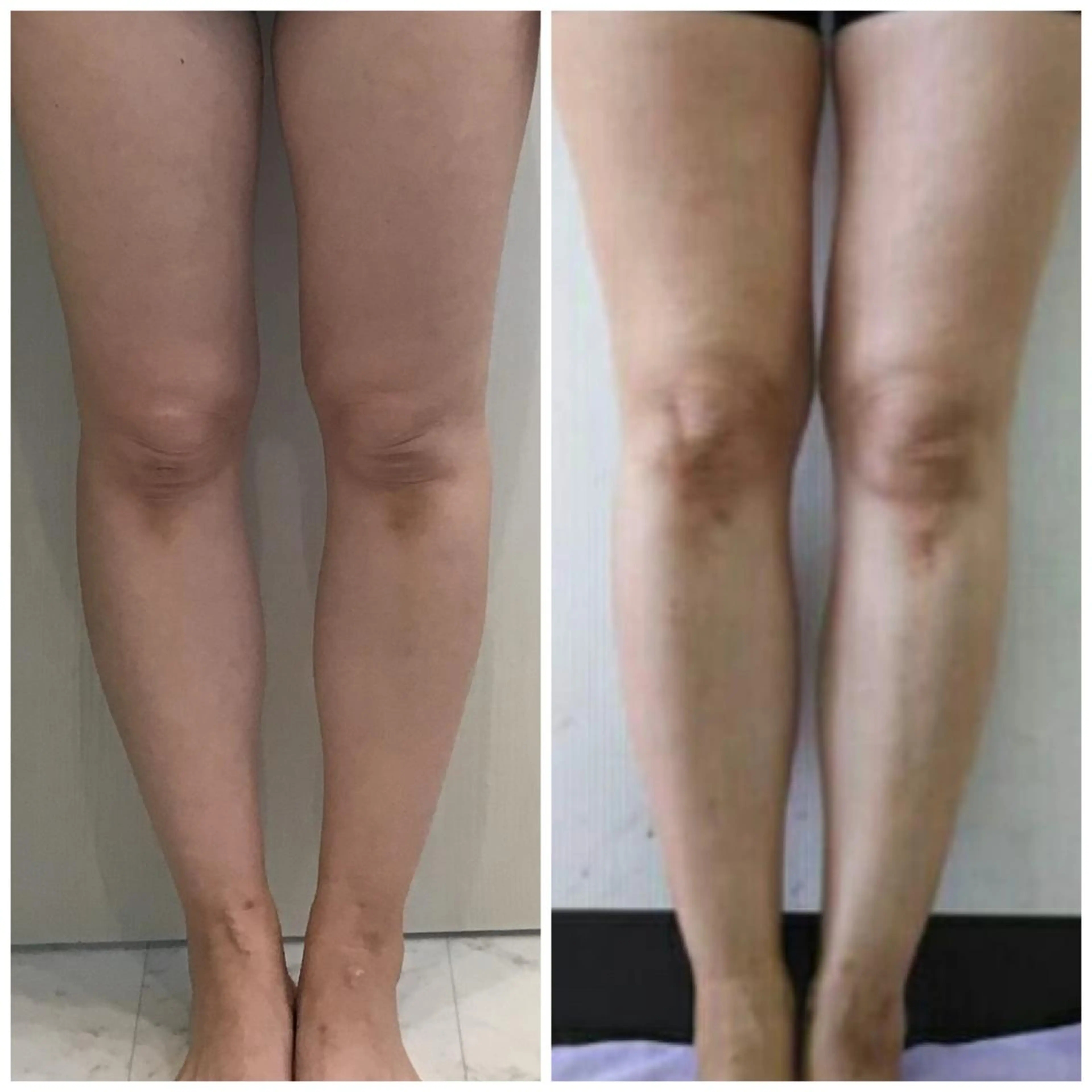 salvatore 富士店のエステ・リラクイメージ