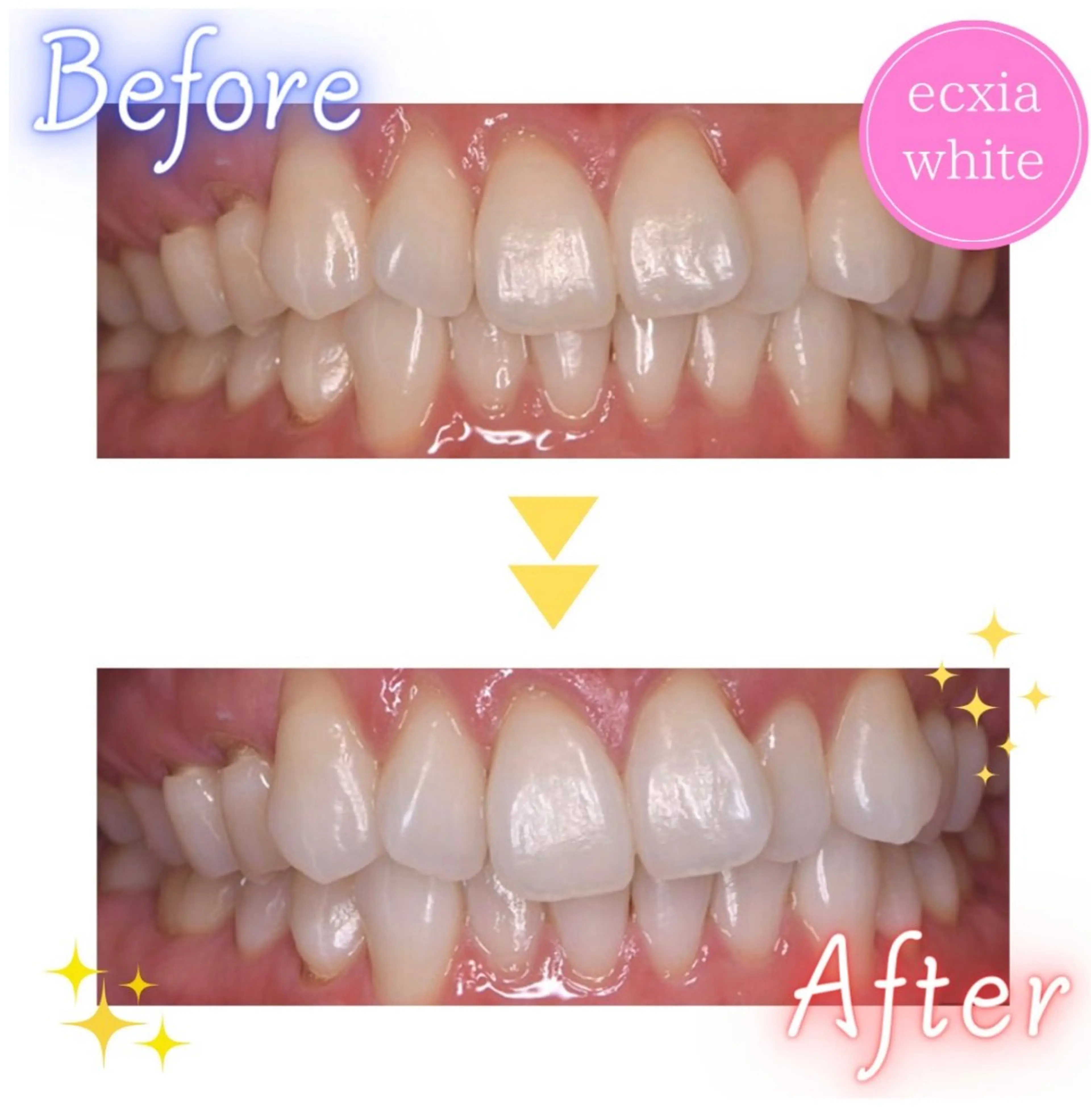 ecxia  white 　広島袋町店所属・セルフホワイトニング エクシア広島袋町店のその他イメージ