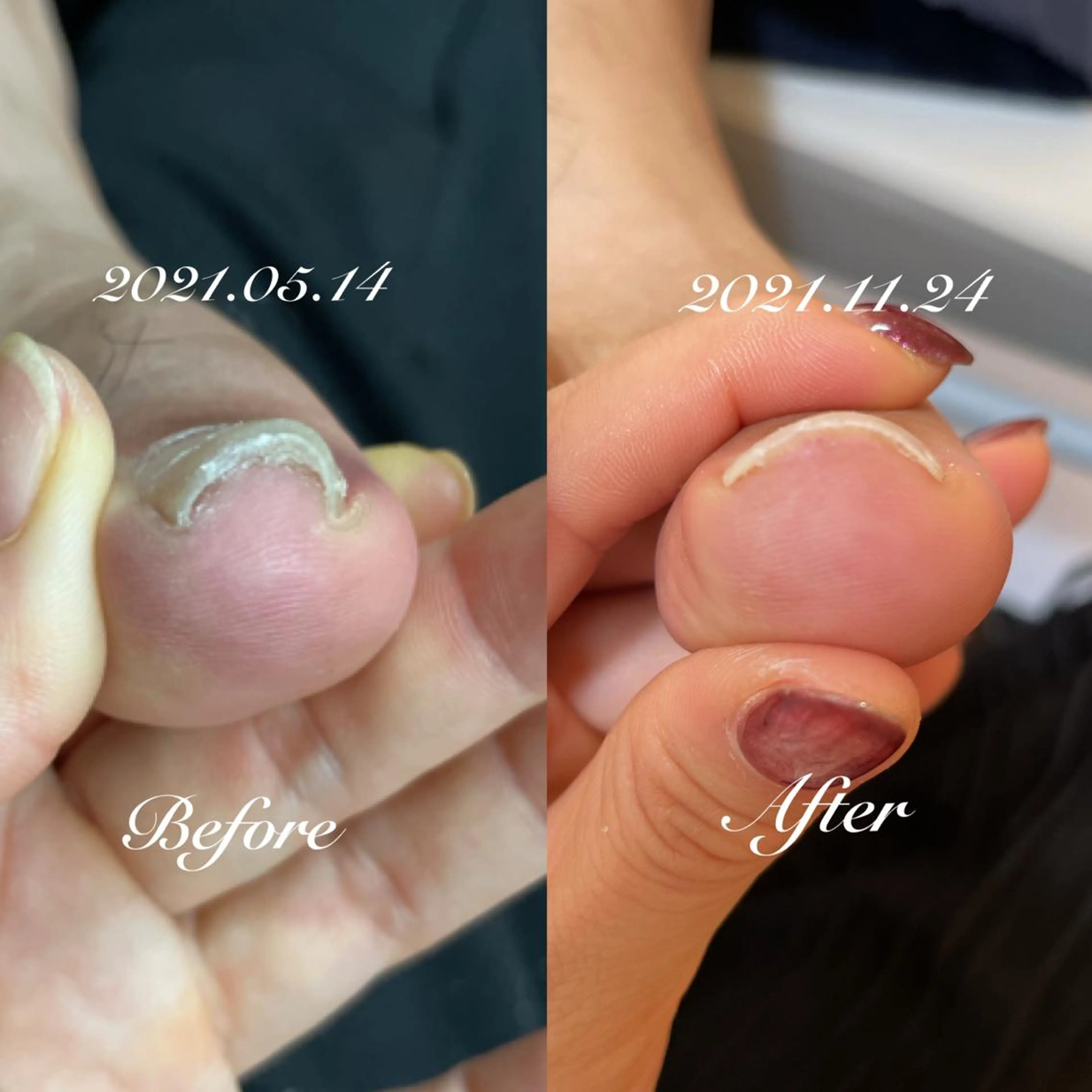 ネイル 卒業式 roconail ヒロコのネイルデザイン