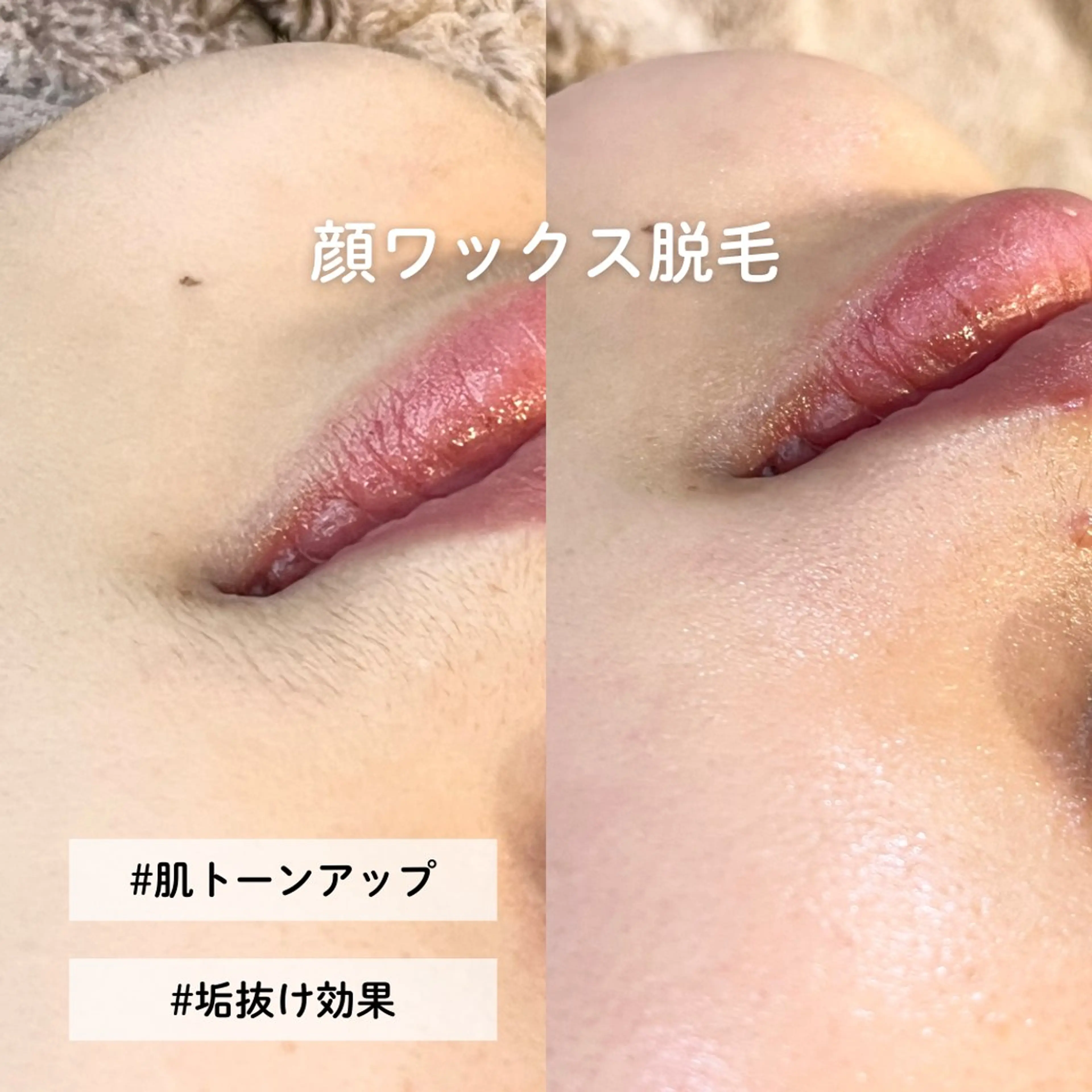 EST BEAUTY所属・顔ワックス脱毛/ ハーブピーリングのエステ・リラクイメージ