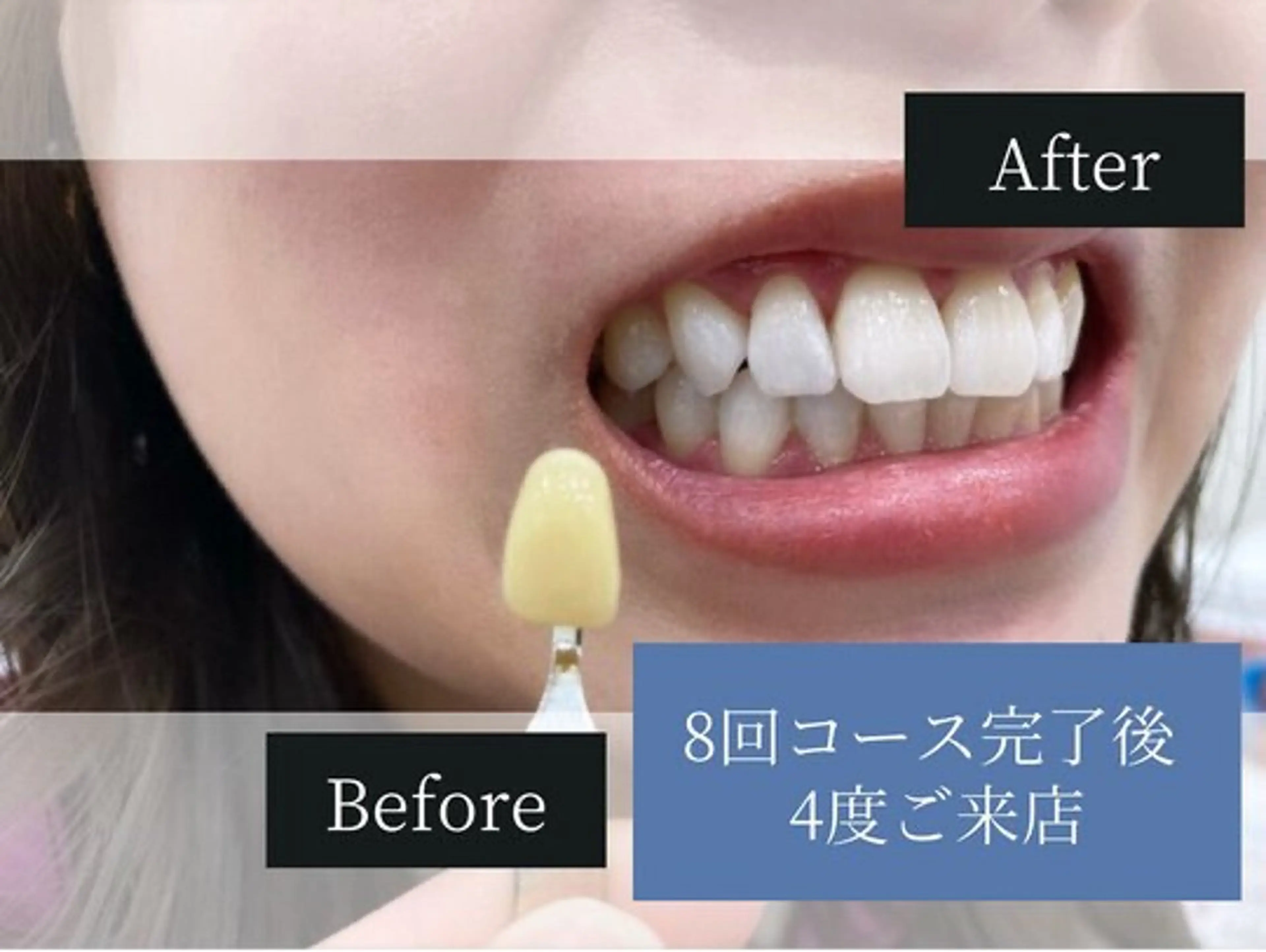 ホワイトニングカフェ荻窪店所属・ホワイトニングカフェ 荻窪店のその他イメージ