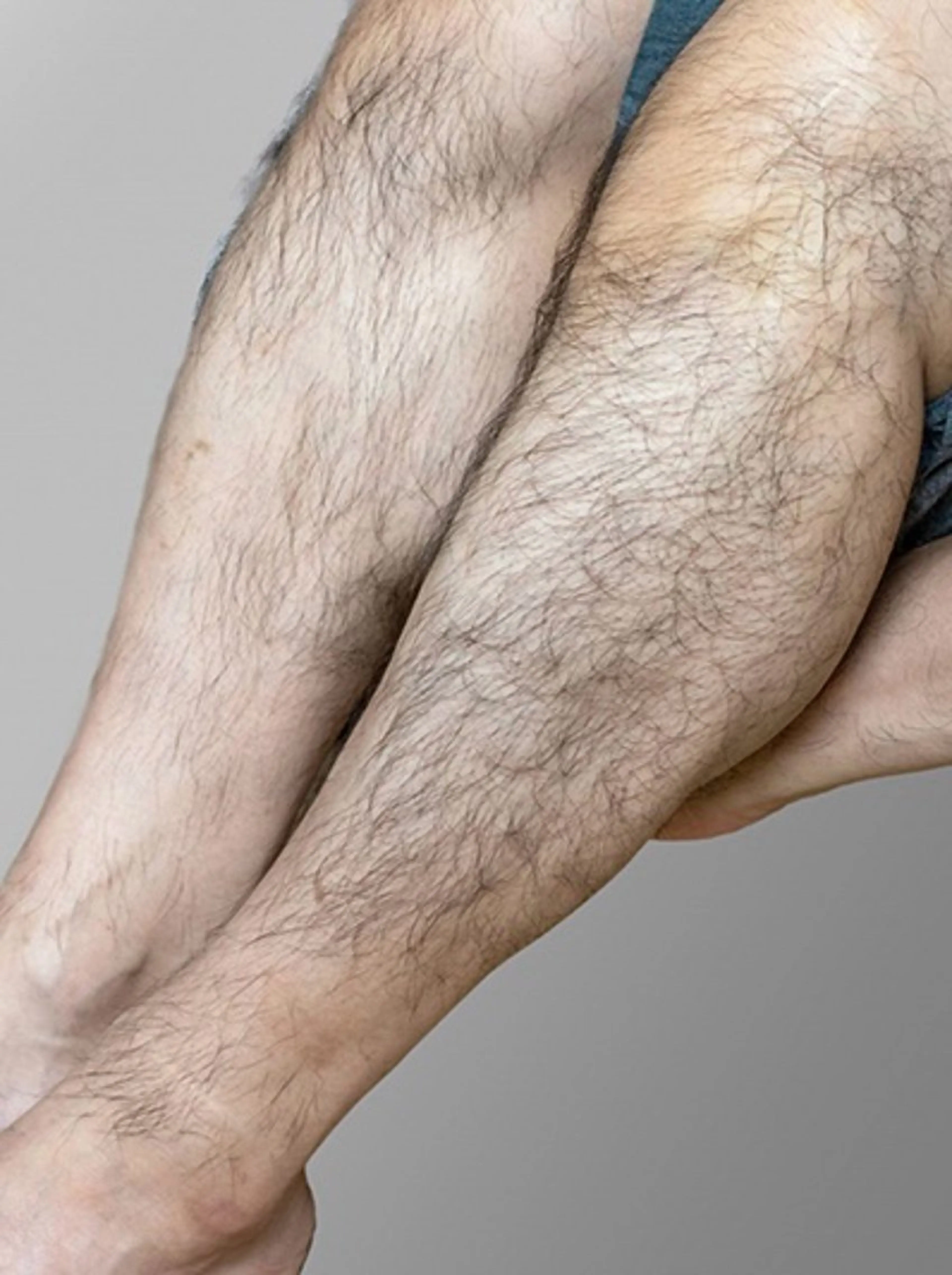 【メンズ】腕足全体（手足指甲指）脱毛（カウンセリング込み）の写真