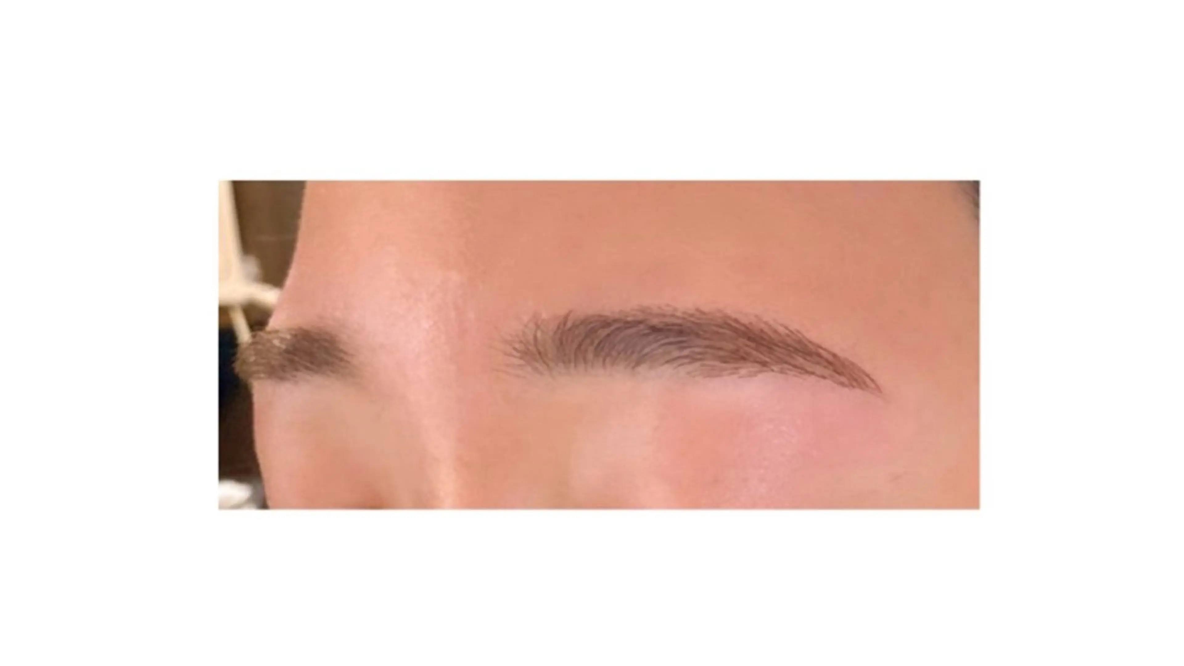 アイブロウ 脱毛 BRISE erikaのエステ・リラクイメージ