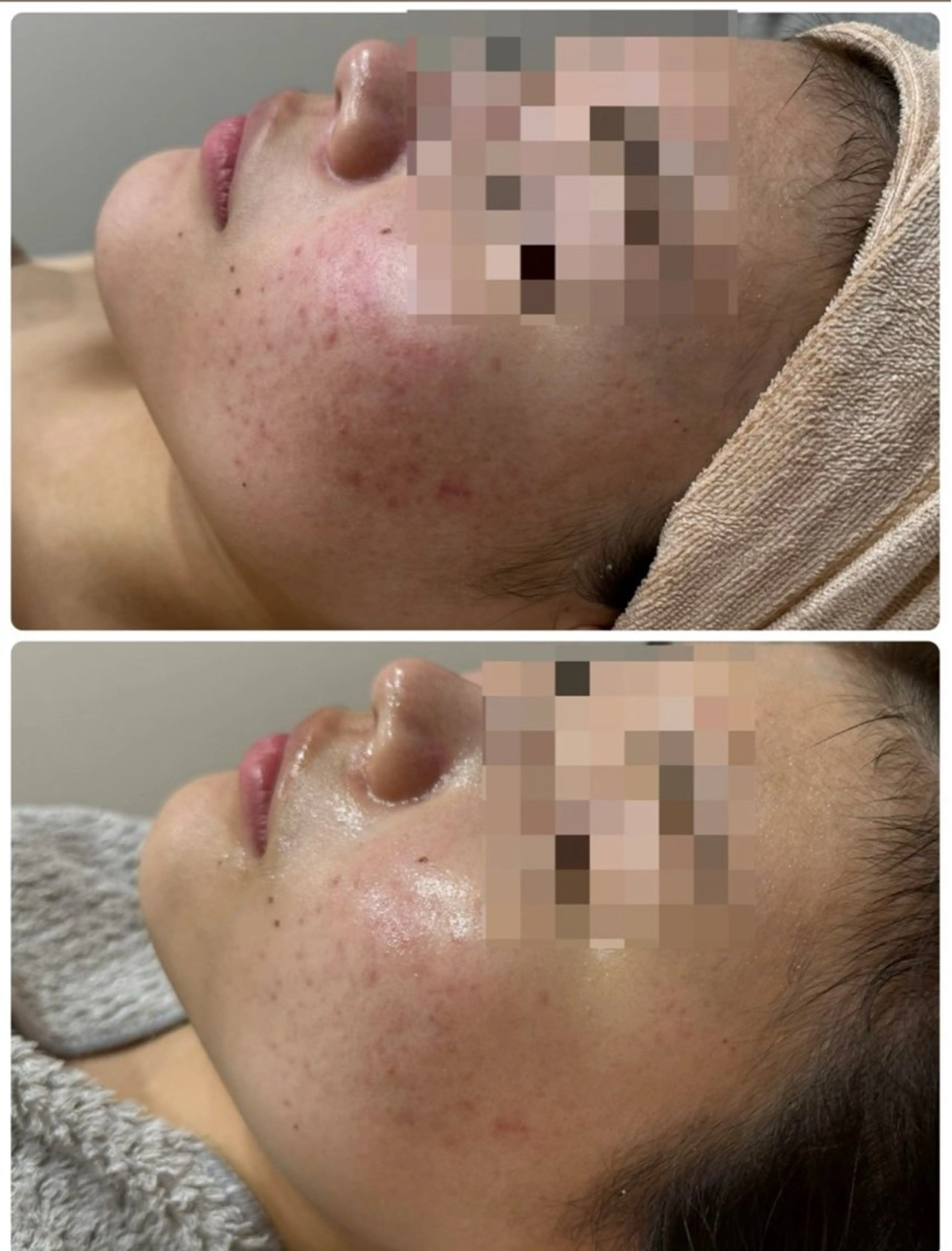 エステ 美肌脱毛サロン muroのエステ・リラクイメージ