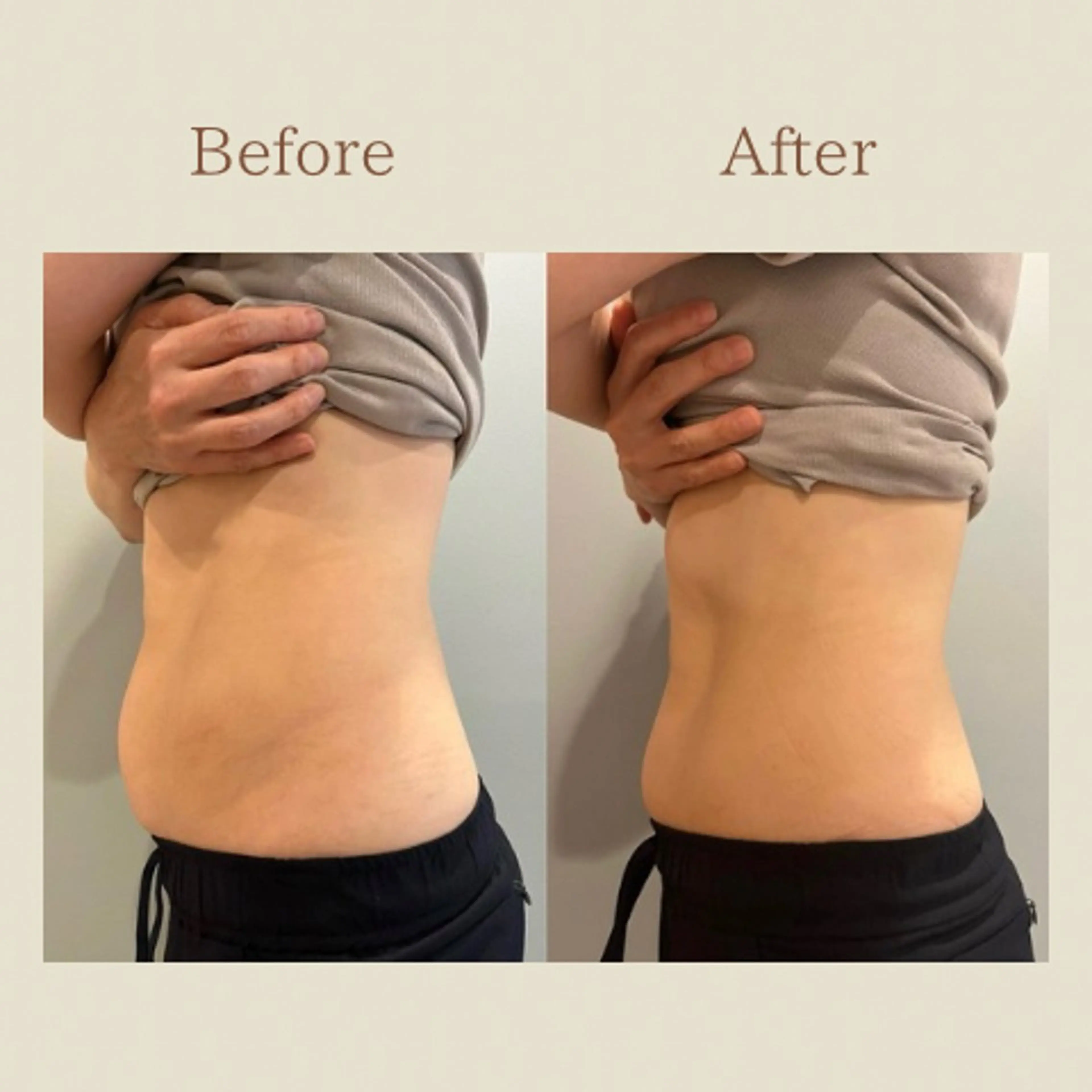 お腹痩せエステ Flat BELLY 恵比寿所属・【腸もみ/冷却痩身】 お腹エステ/恵比寿のエステ・リラクイメージ