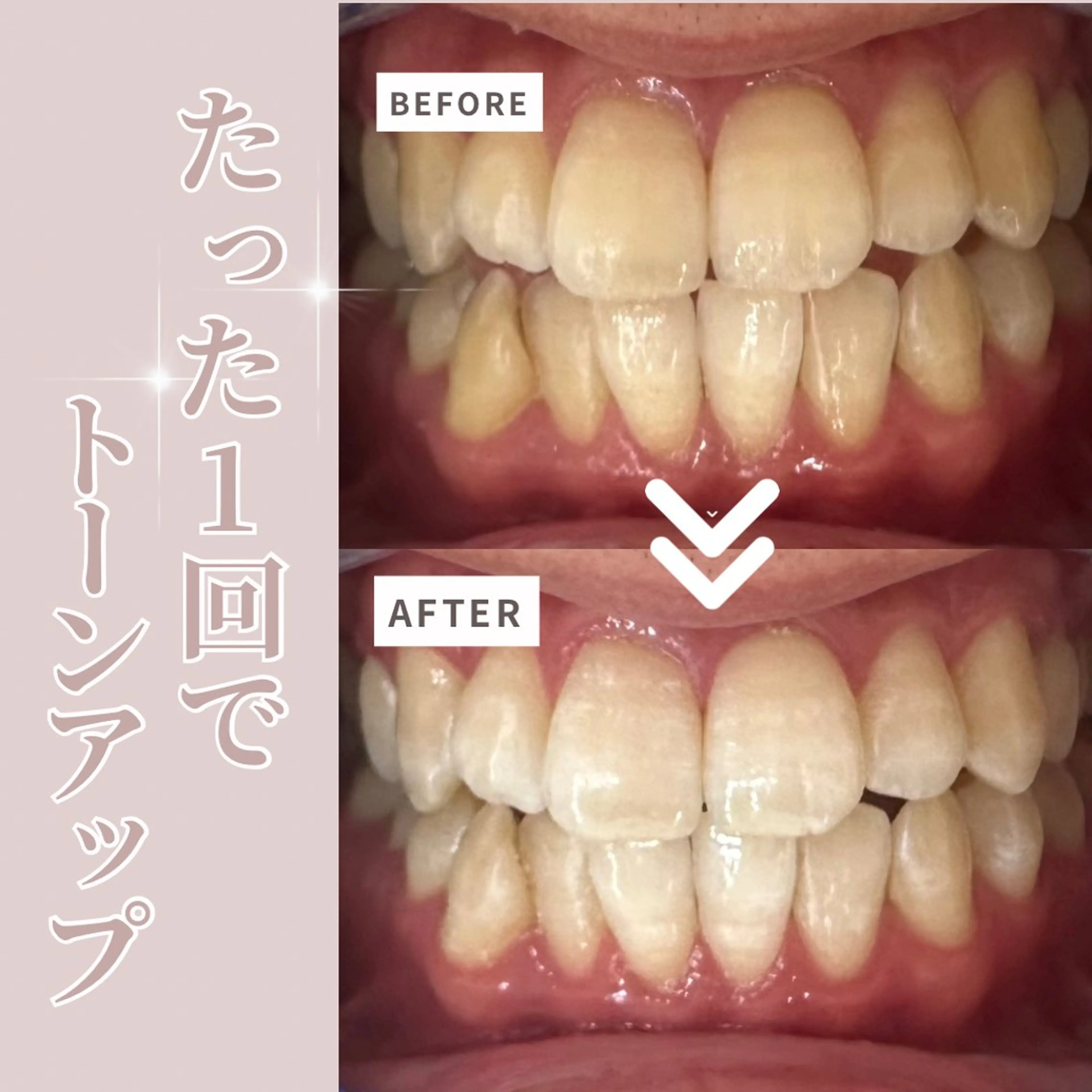 LIBRA自由が丘所属・LIBRA自由が丘 ホワイトニングのその他イメージ