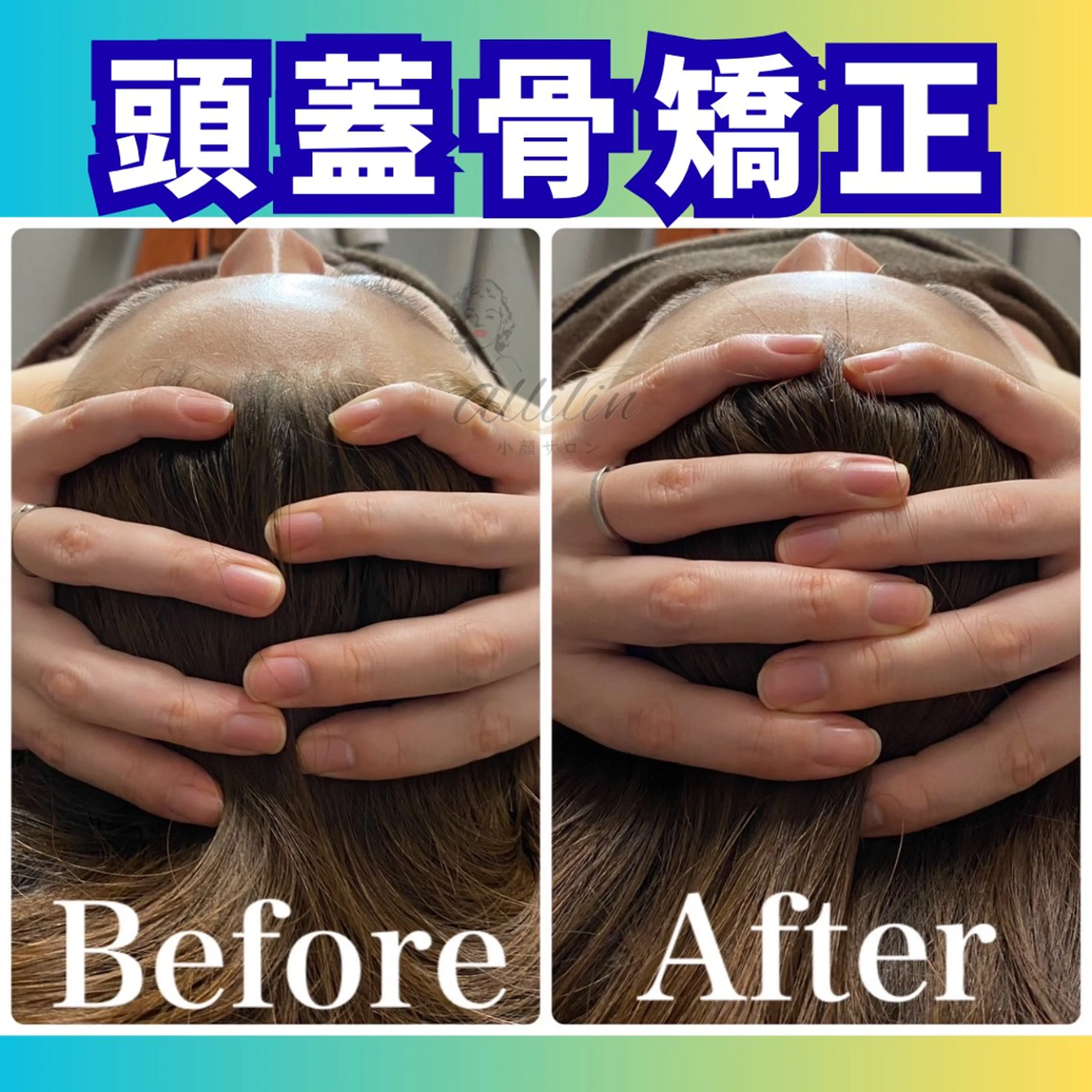 💎小顔ｻﾛﾝ アリリン銀座💎のエステ・リラクイメージ