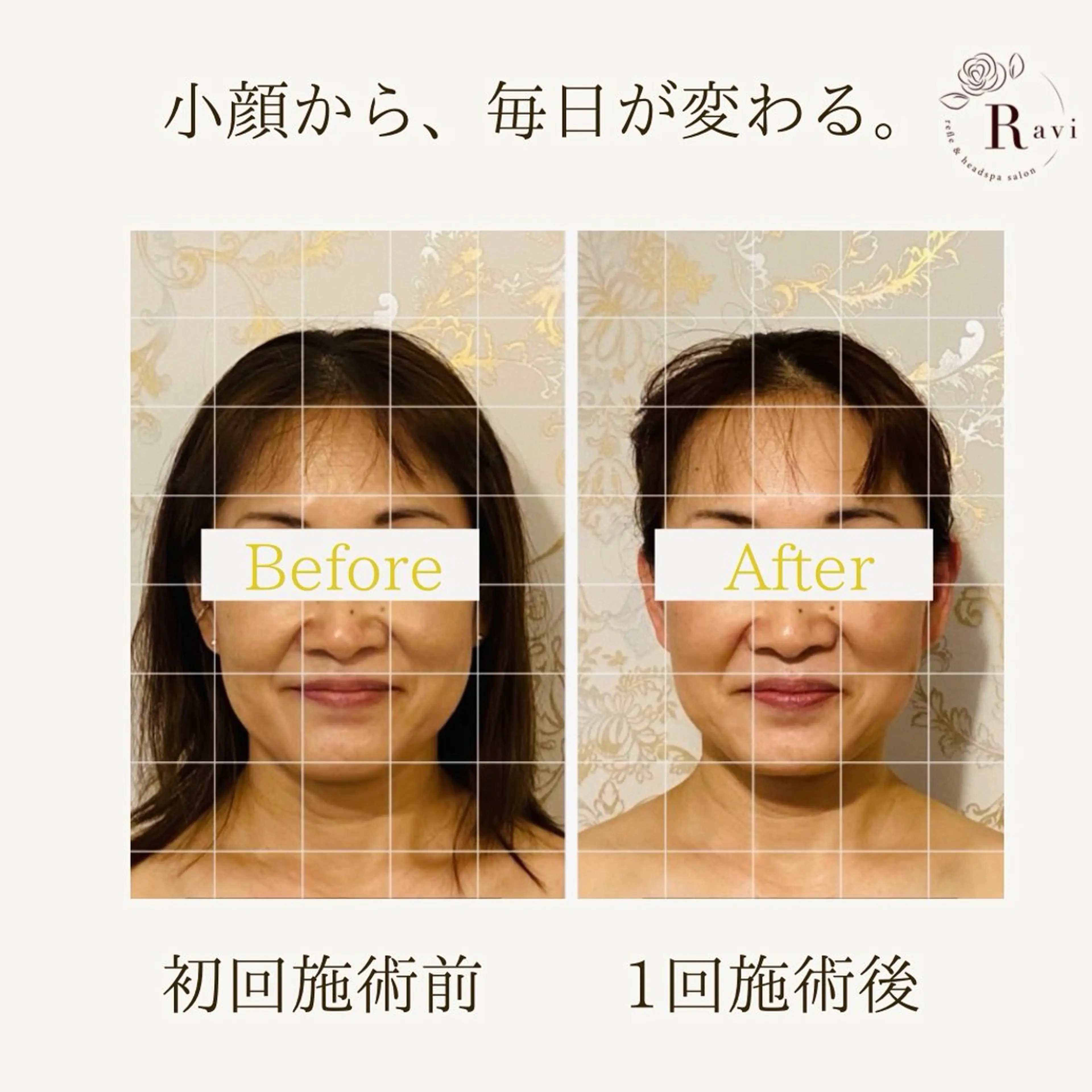 小顔サロンラヴィ　　船橋馬込沢店所属・小顔サロンラヴィ 船橋のエステ・リラクイメージ