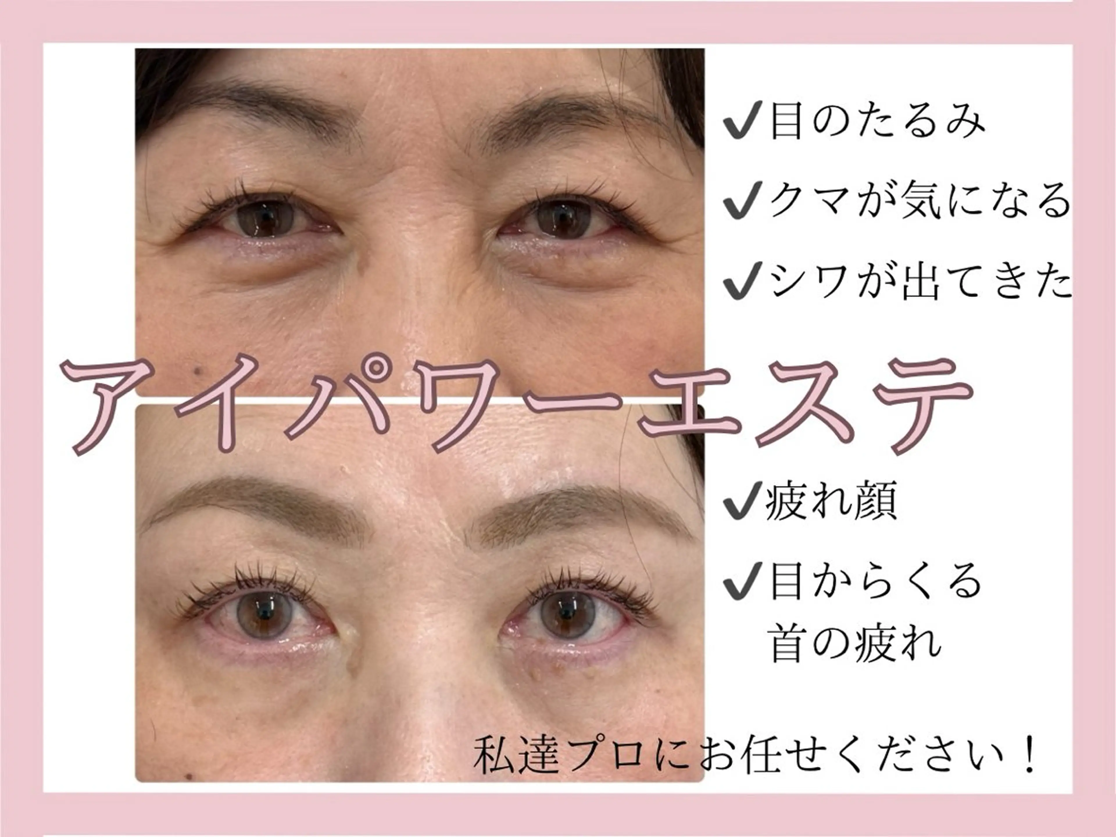 【クマ・シワ・たるみの集中ケア 】16万人以上が体感した目元特化エステ体験！眼精疲労改善、まつ毛も太く育てます✨️の写真