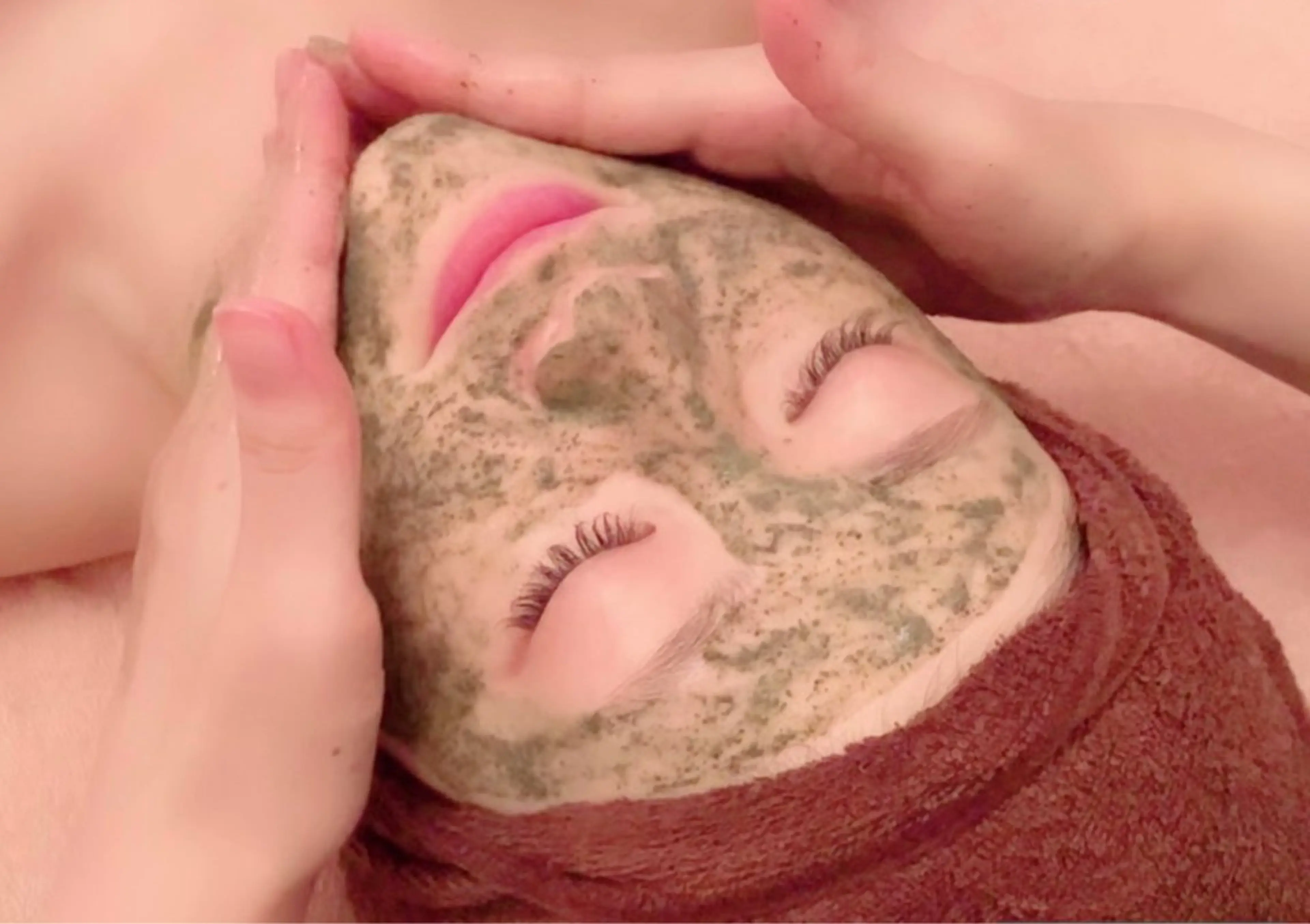 【3/25迄スペシャルクーポン】ハーブピーリング＋選べるオプションプレゼント🎁の写真