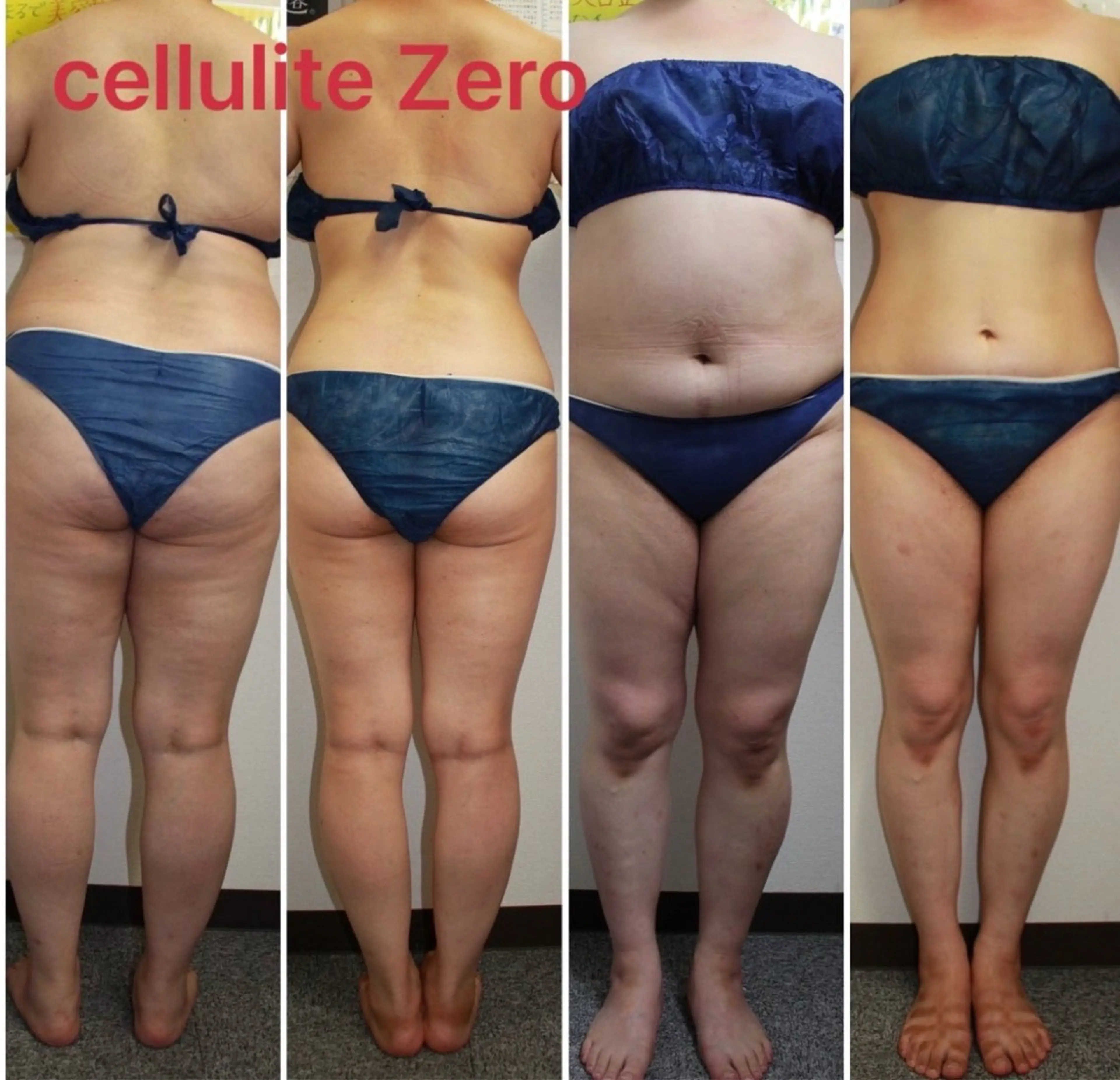 エステ beauty SalonRcoinのマツエク・マツパデザイン