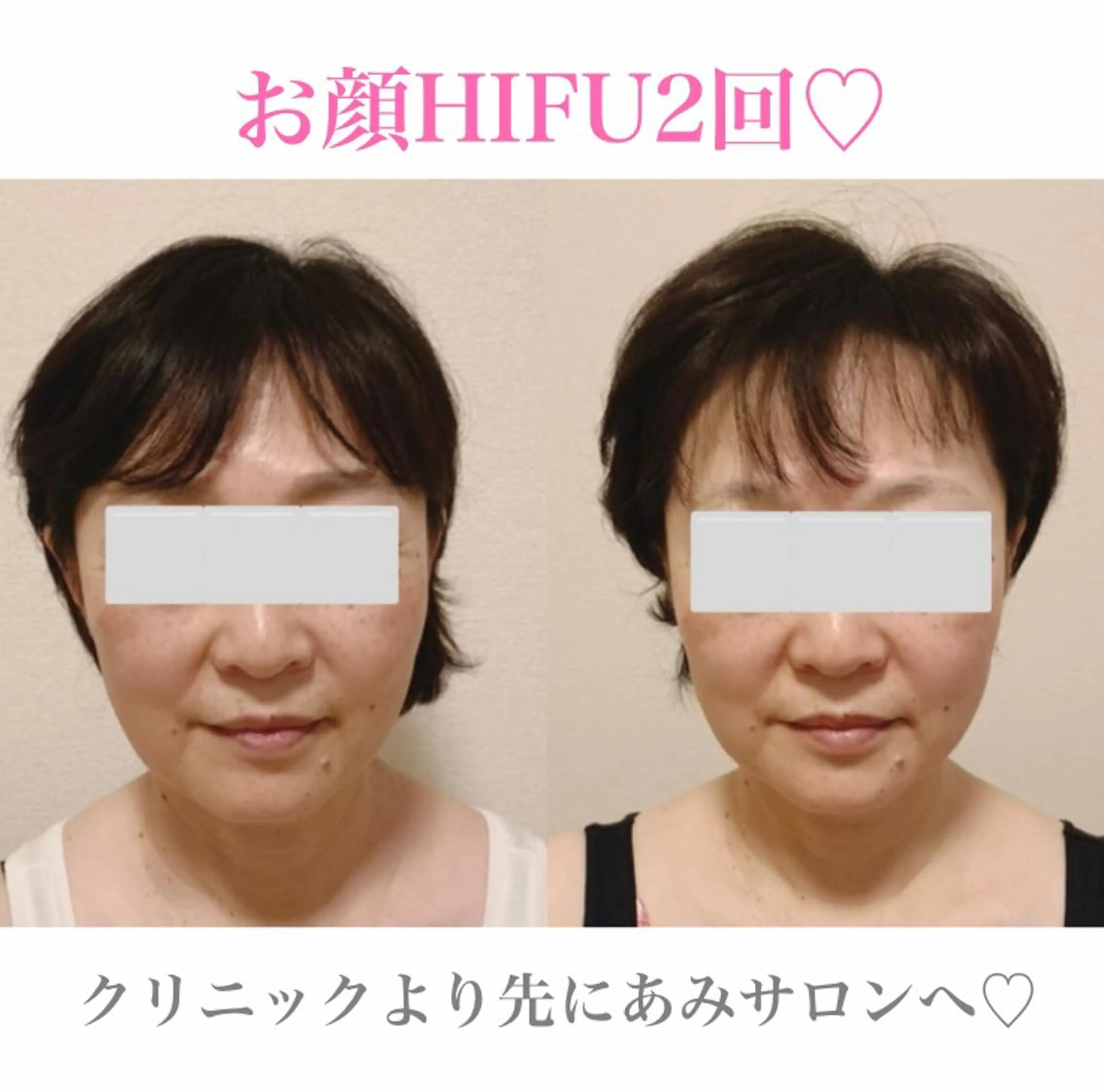 a  room salonのエステ・リラクイメージ