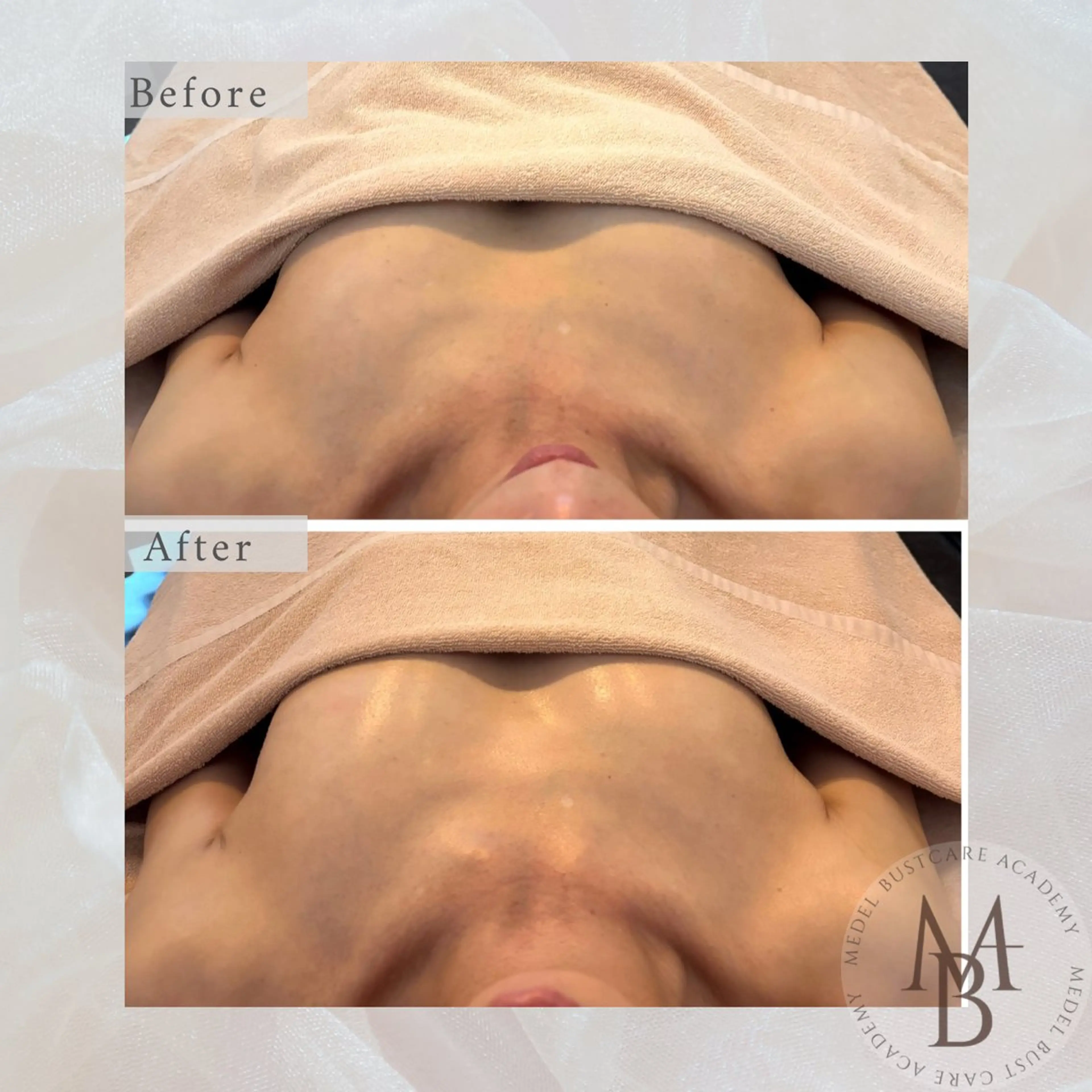 IHANA. バストケアサロンのエステ・リラクイメージ