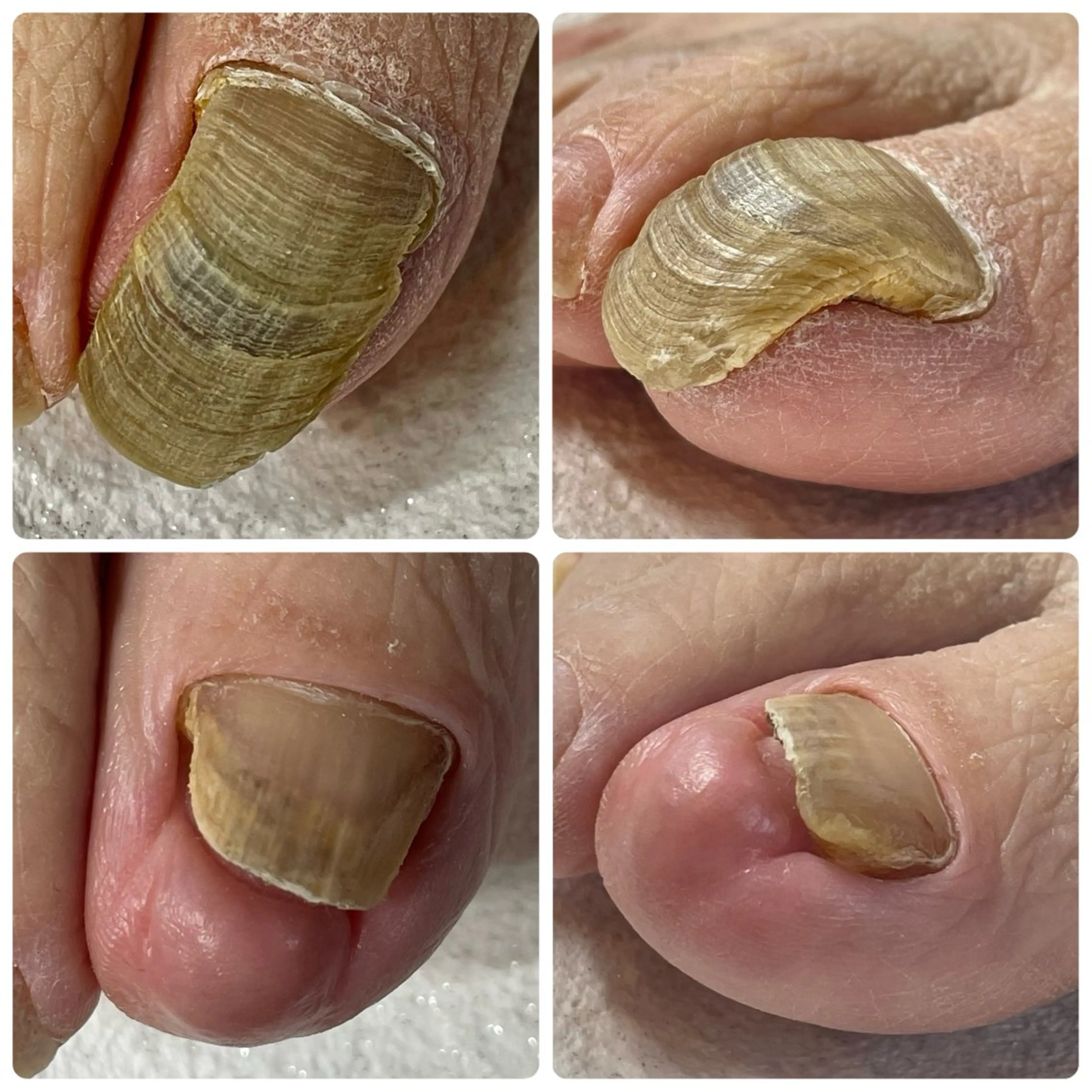 札幌ネイルgorella所属・gorella Ａのネイルデザイン