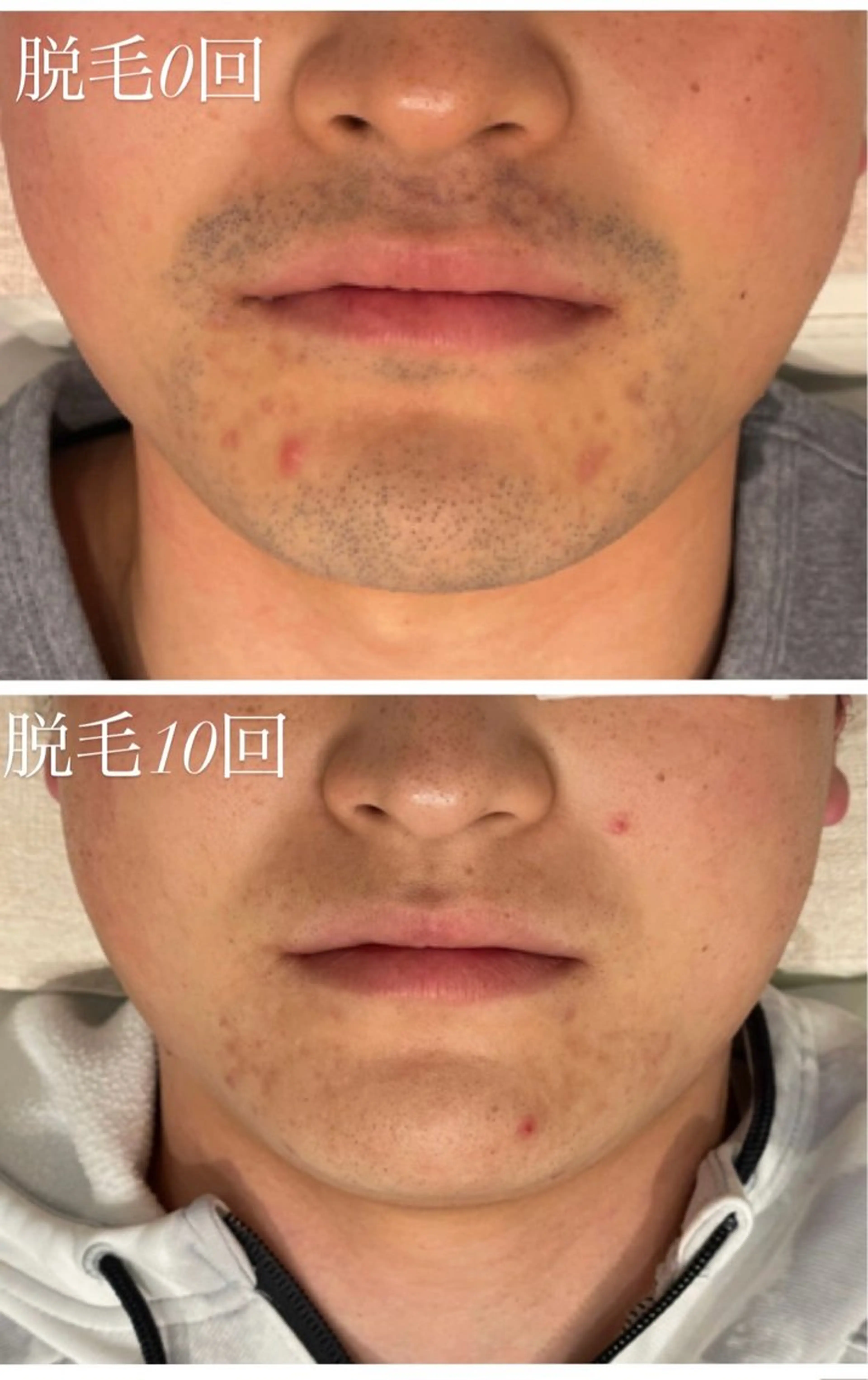 TotalBeautySalon UNCHEL所属・Ito ayakaのマツエク・マツパデザイン