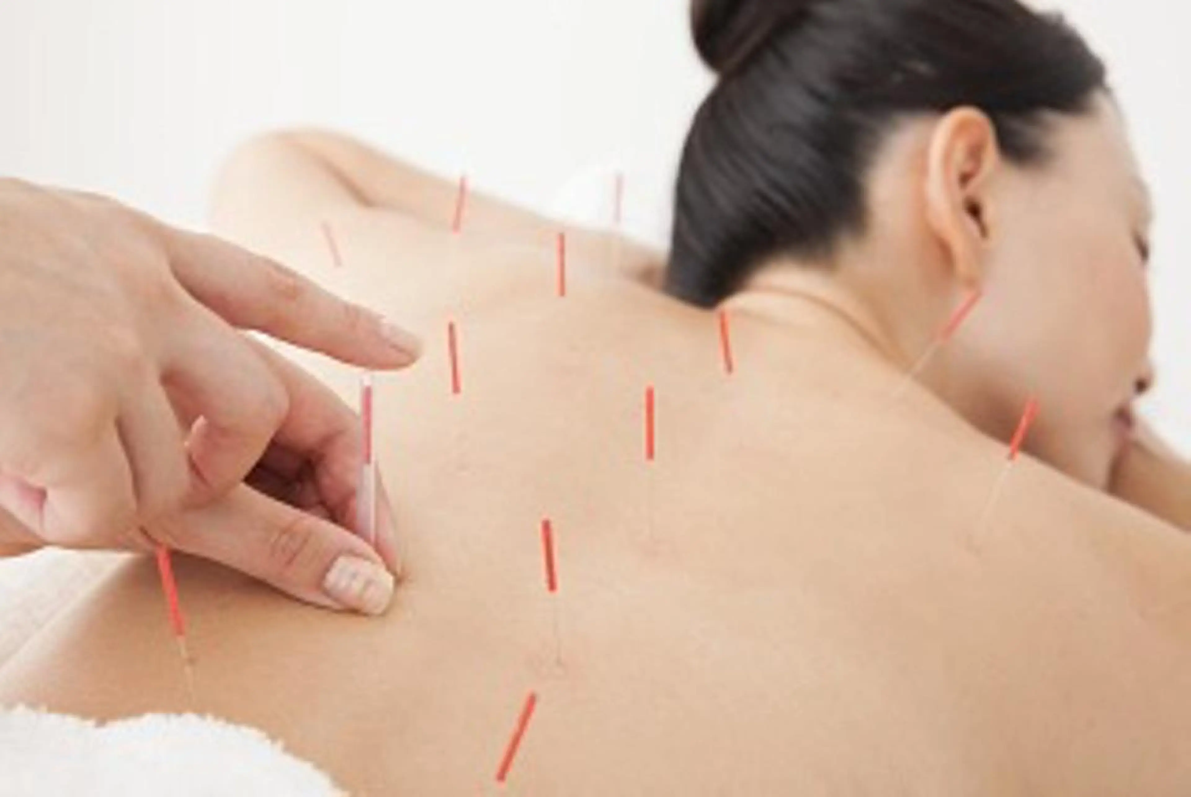 鍼灸治療室　Crysta所属・痣にならないヒト幹細 胞美容鍼/坂井里帆のその他イメージ