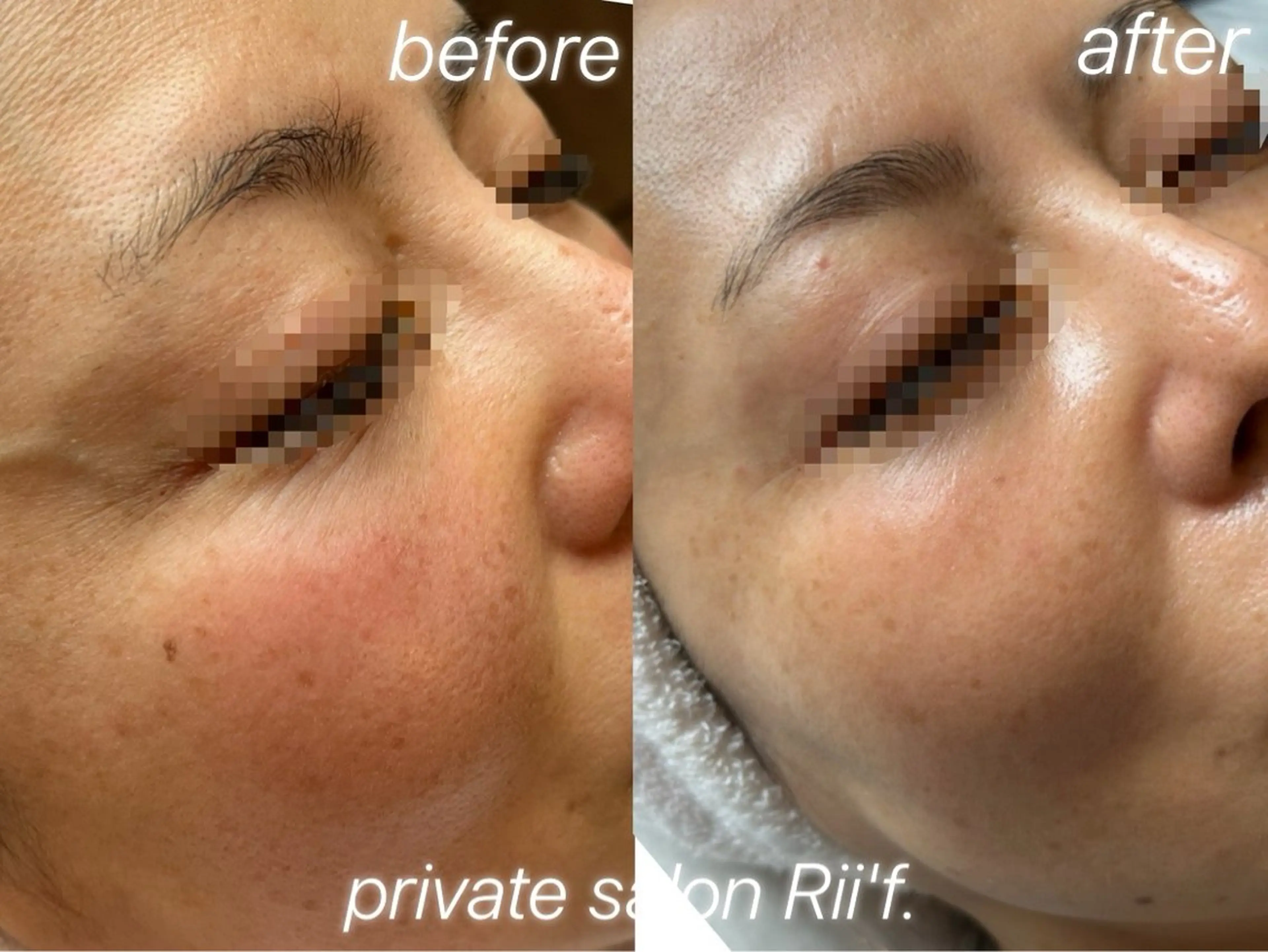 エステ private salon Rii'f.所属・private sa lon Rii'f.のエステ・リラクイメージ