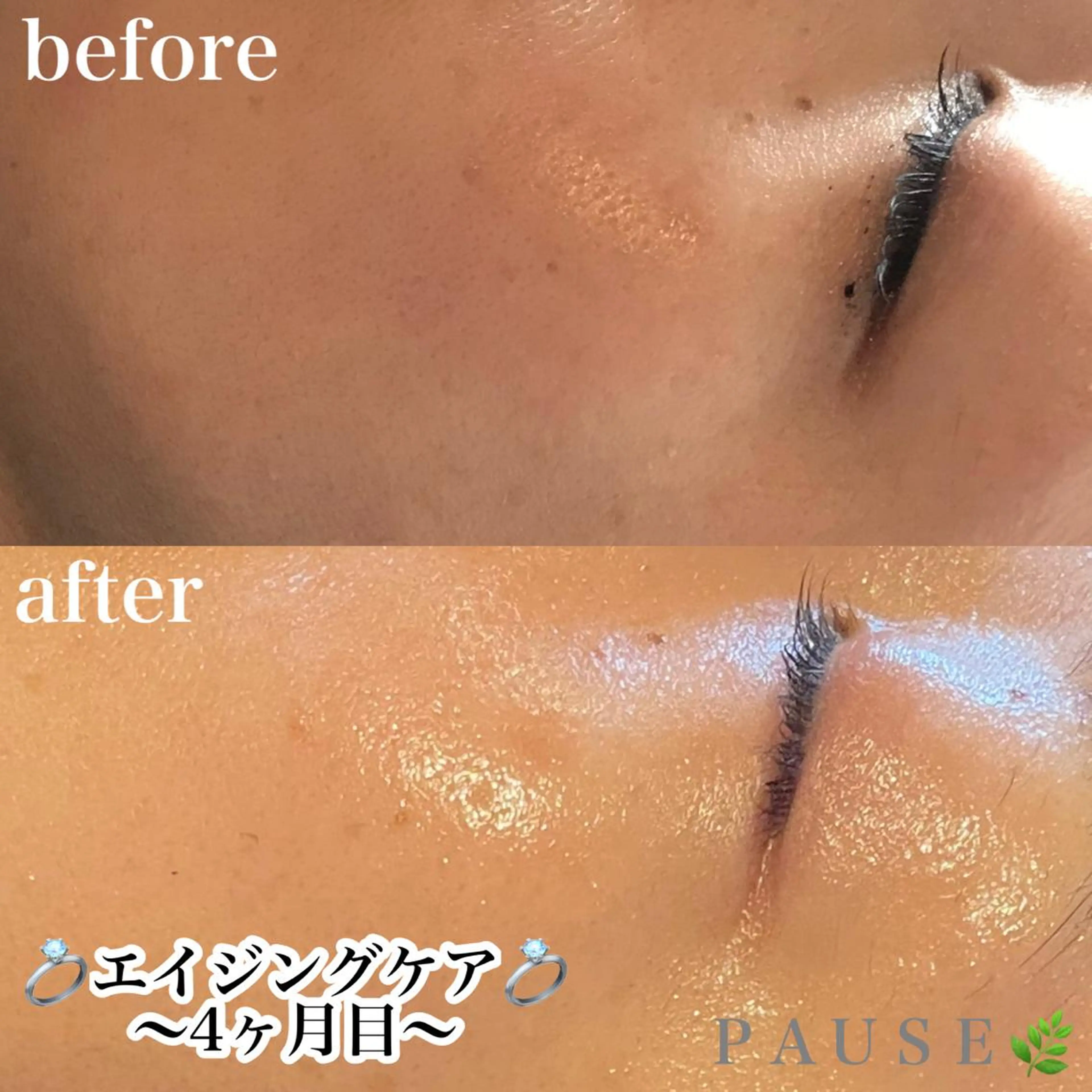 エステ 浜野 恵美のエステ・リラクイメージ