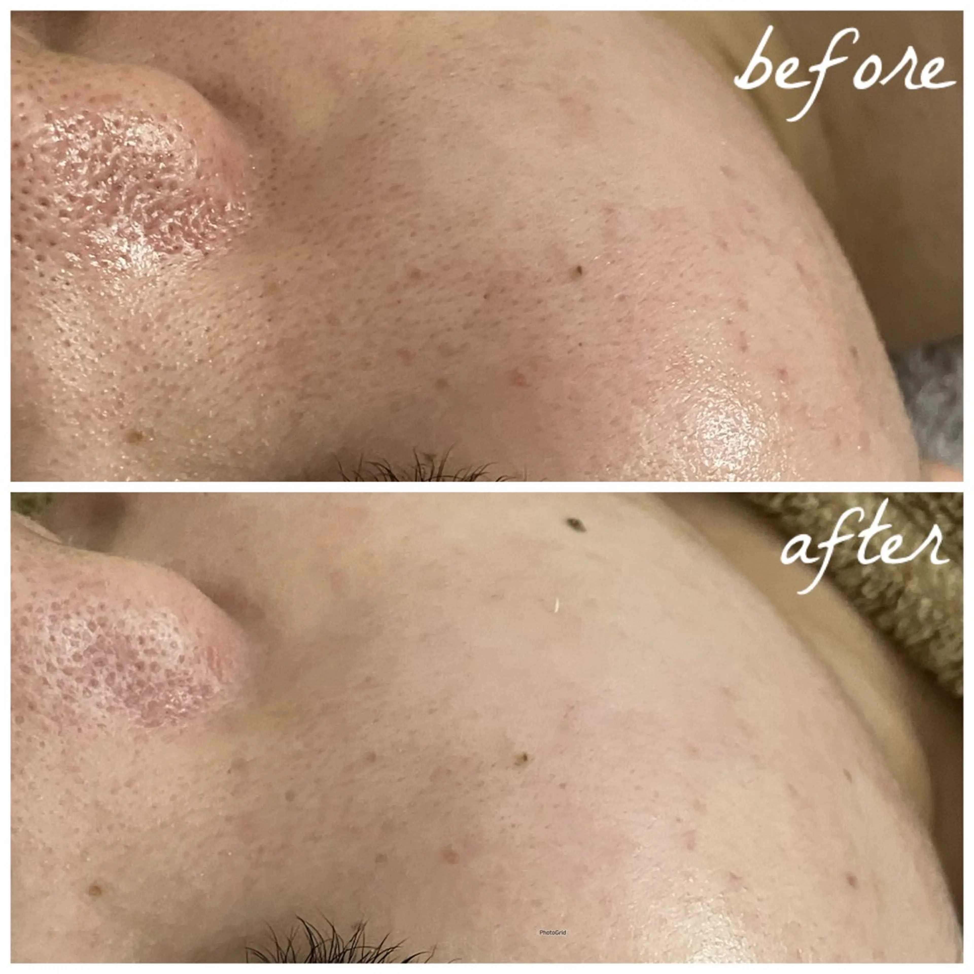 メンズ エステ メナード岐阜茜部 杉浦のエステ・リラクイメージ