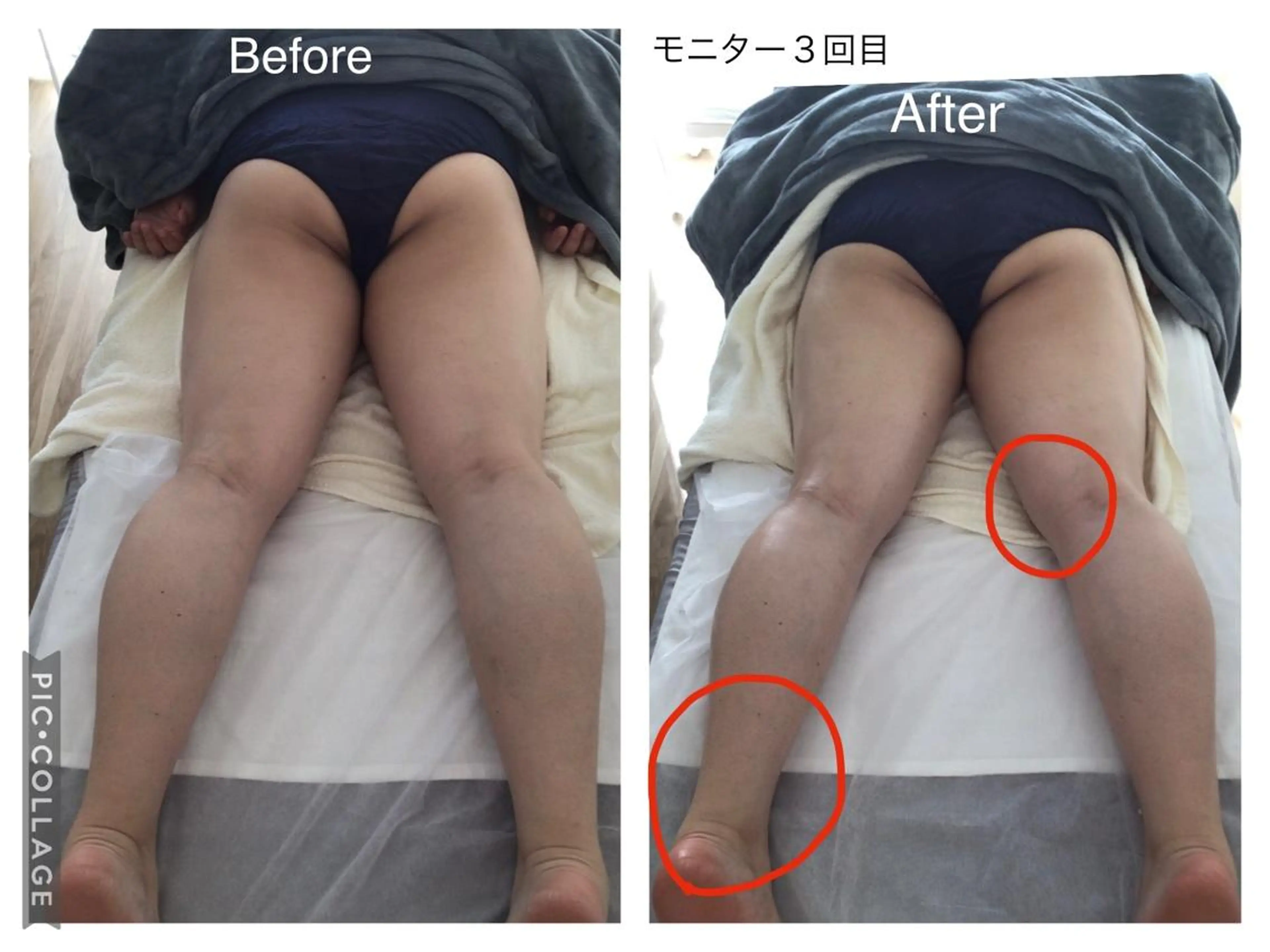 子宮矯正/腸揉み/ シュガーリング脱毛のエステ・リラクイメージ