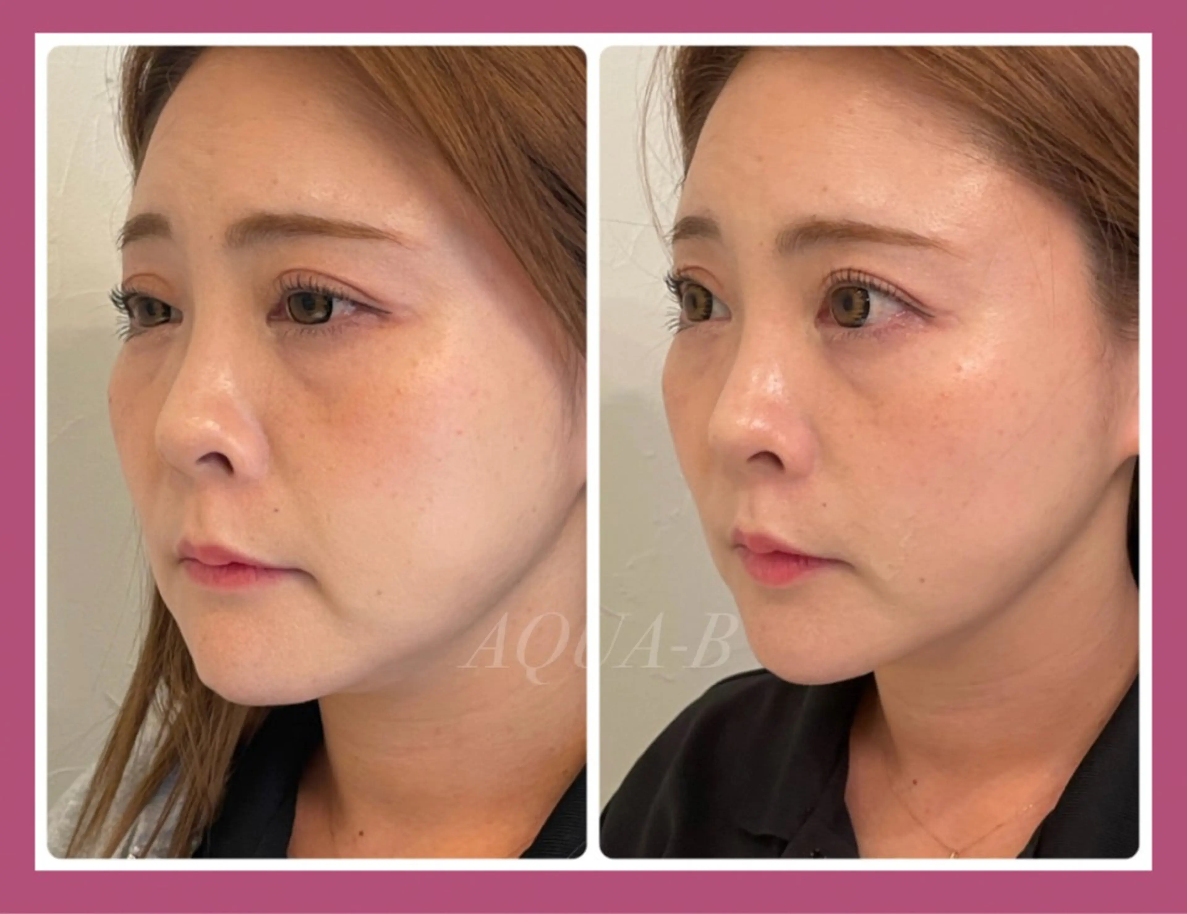 盛れる小顔矯正師 たく先生のエステ・リラクイメージ