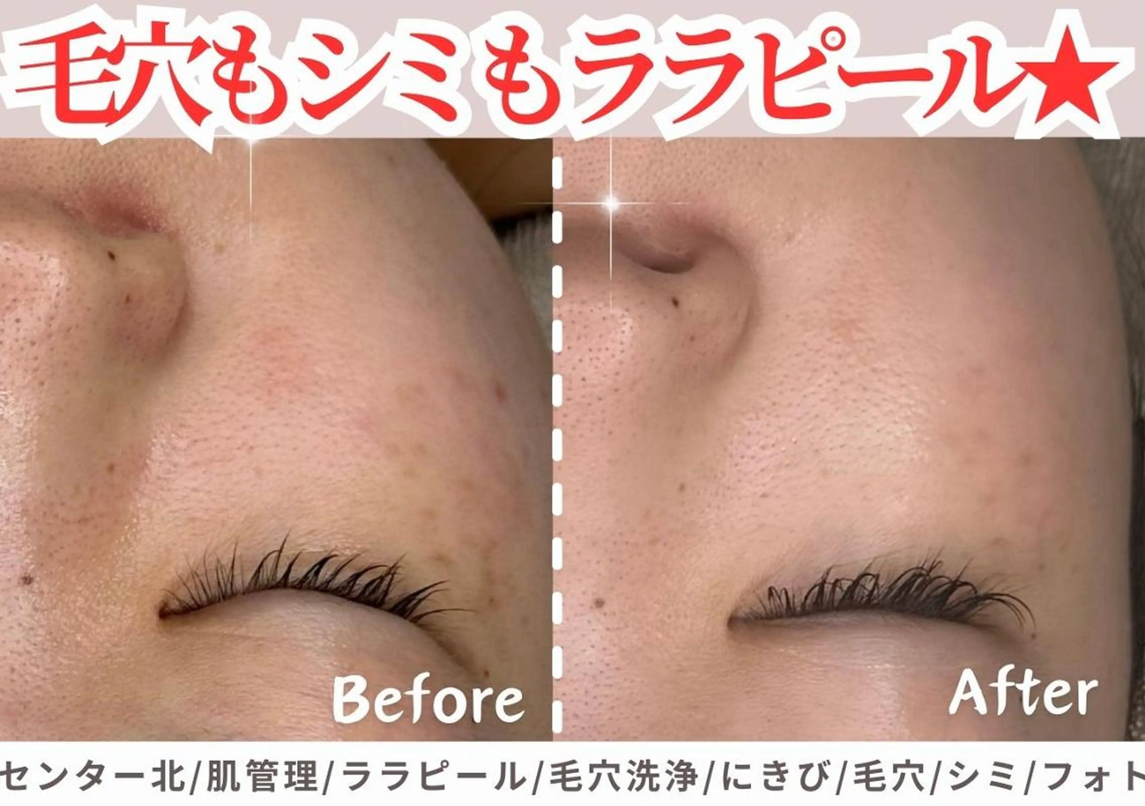 sii センター北 AIのエステ・リラクイメージ