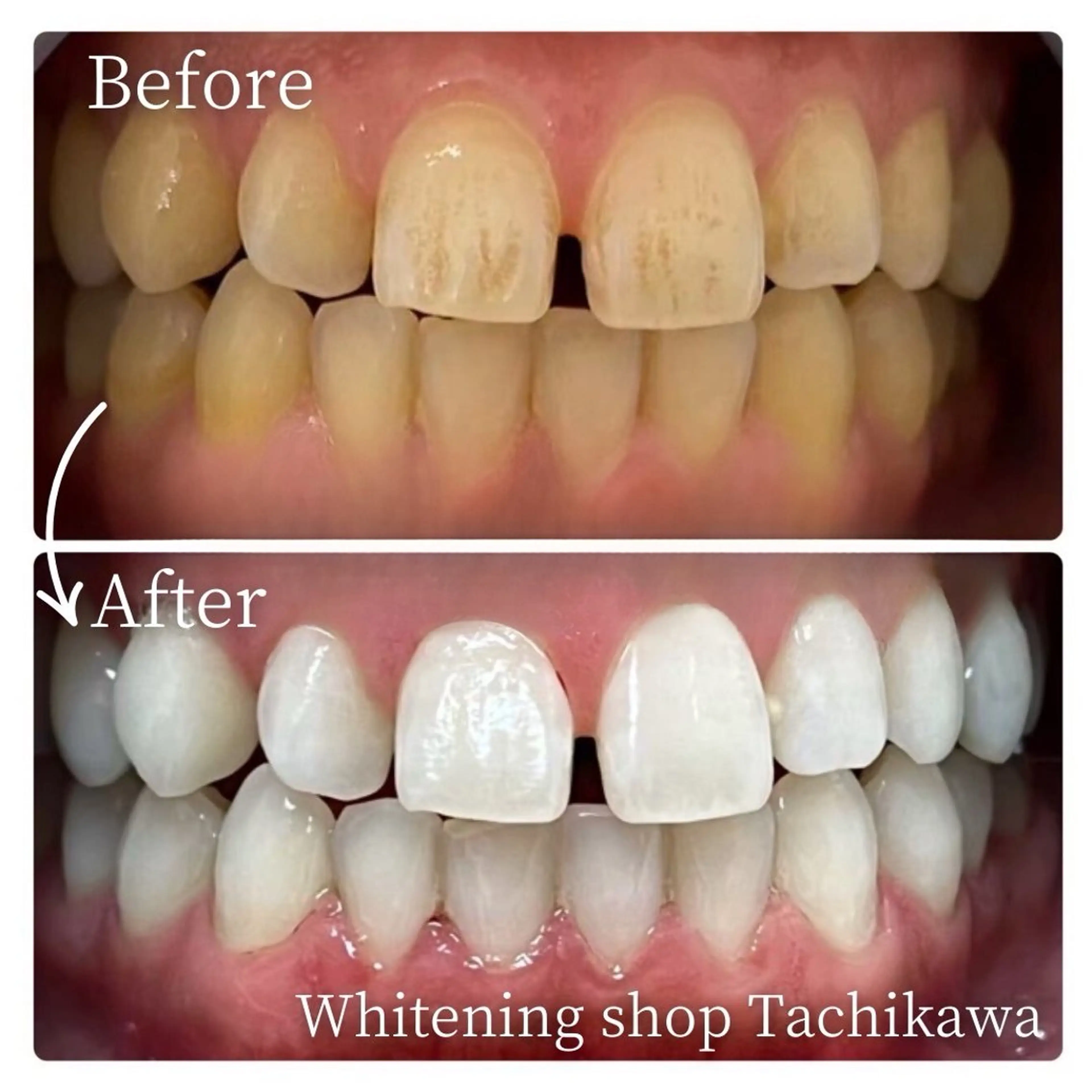 セルフ　ホワイト ニングショップ立川のその他イメージ